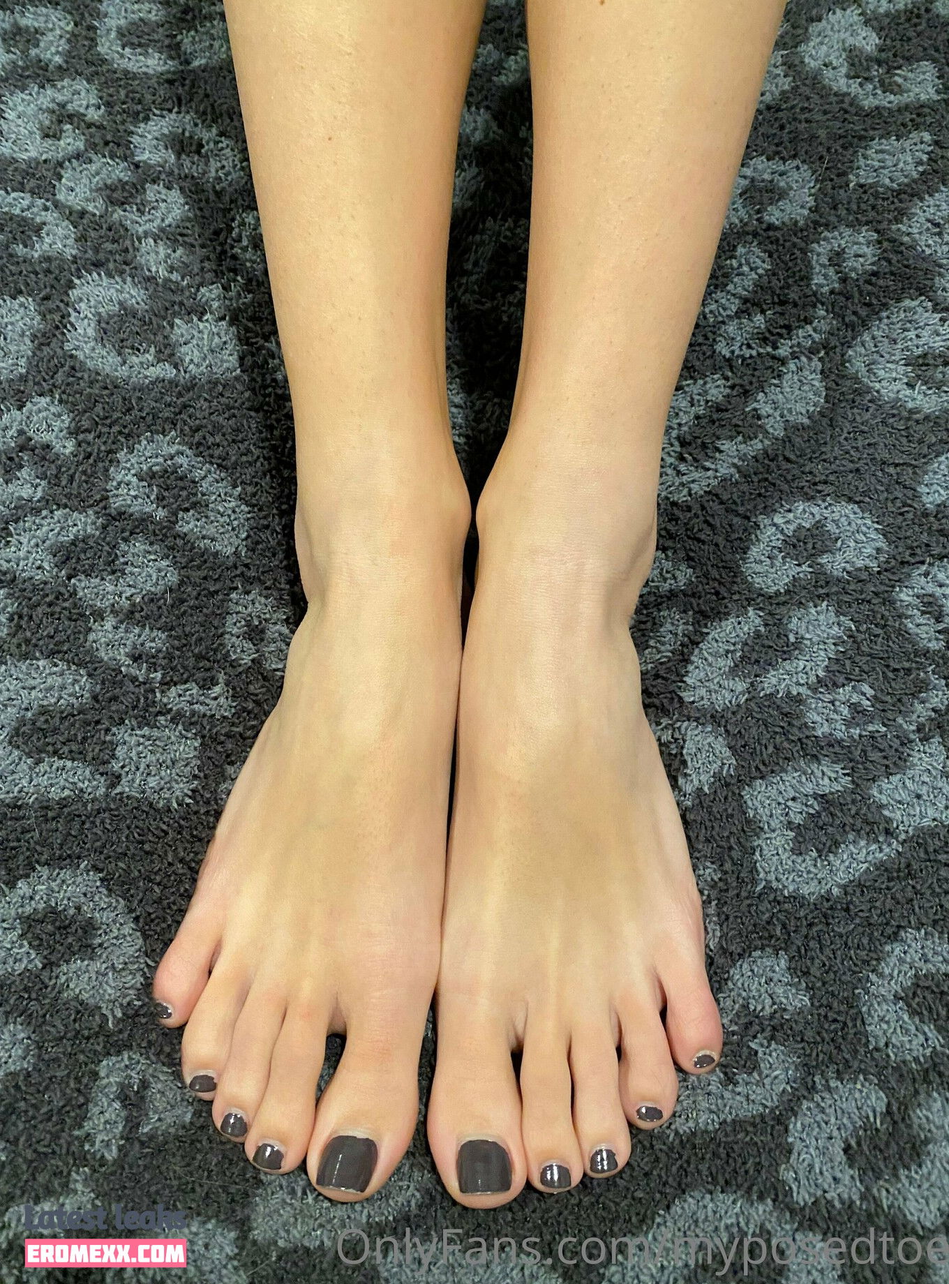 myposedtoes nude Leaked onlyfans - Erome