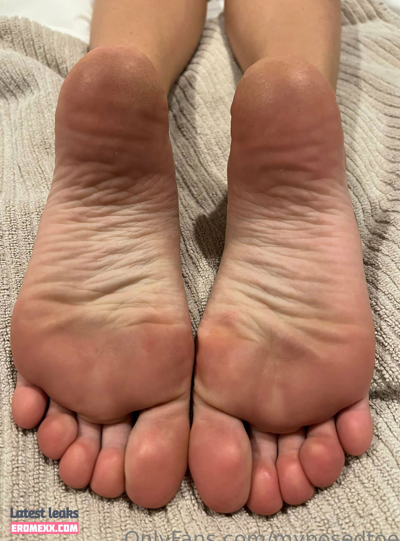 myposedtoes nude Leaked onlyfans - Erome