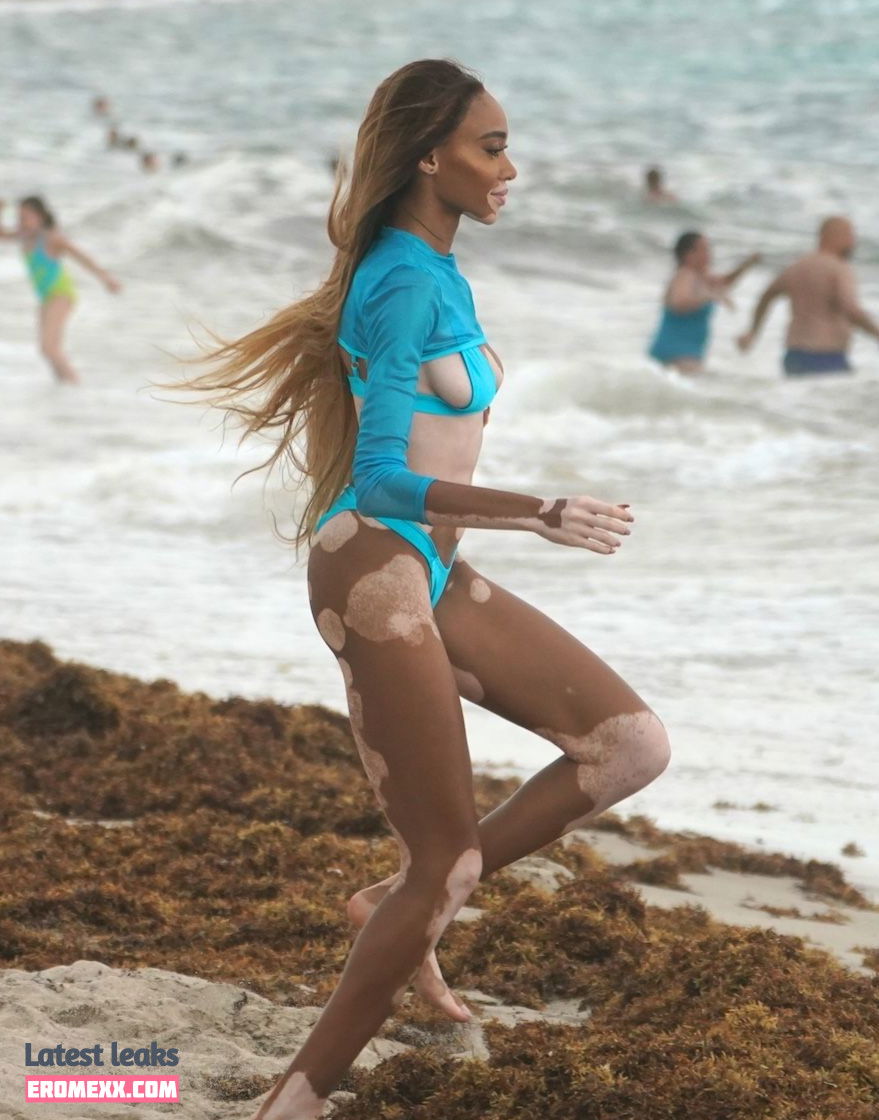 Latest Leaks Winnie Harlow Nude #100 - Fapello