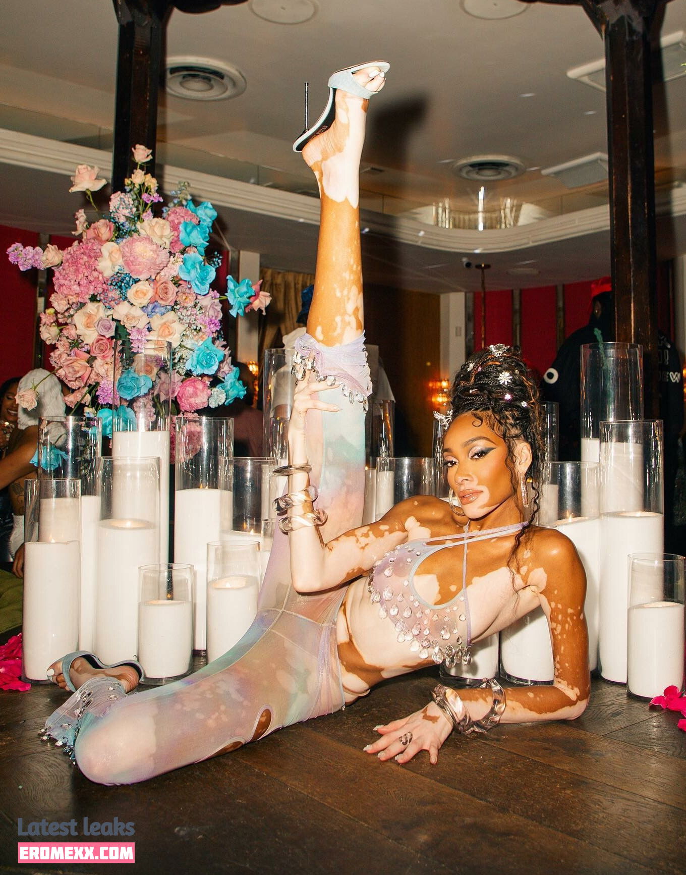 Latest Leaks Winnie Harlow Nude #1003 - Fapello