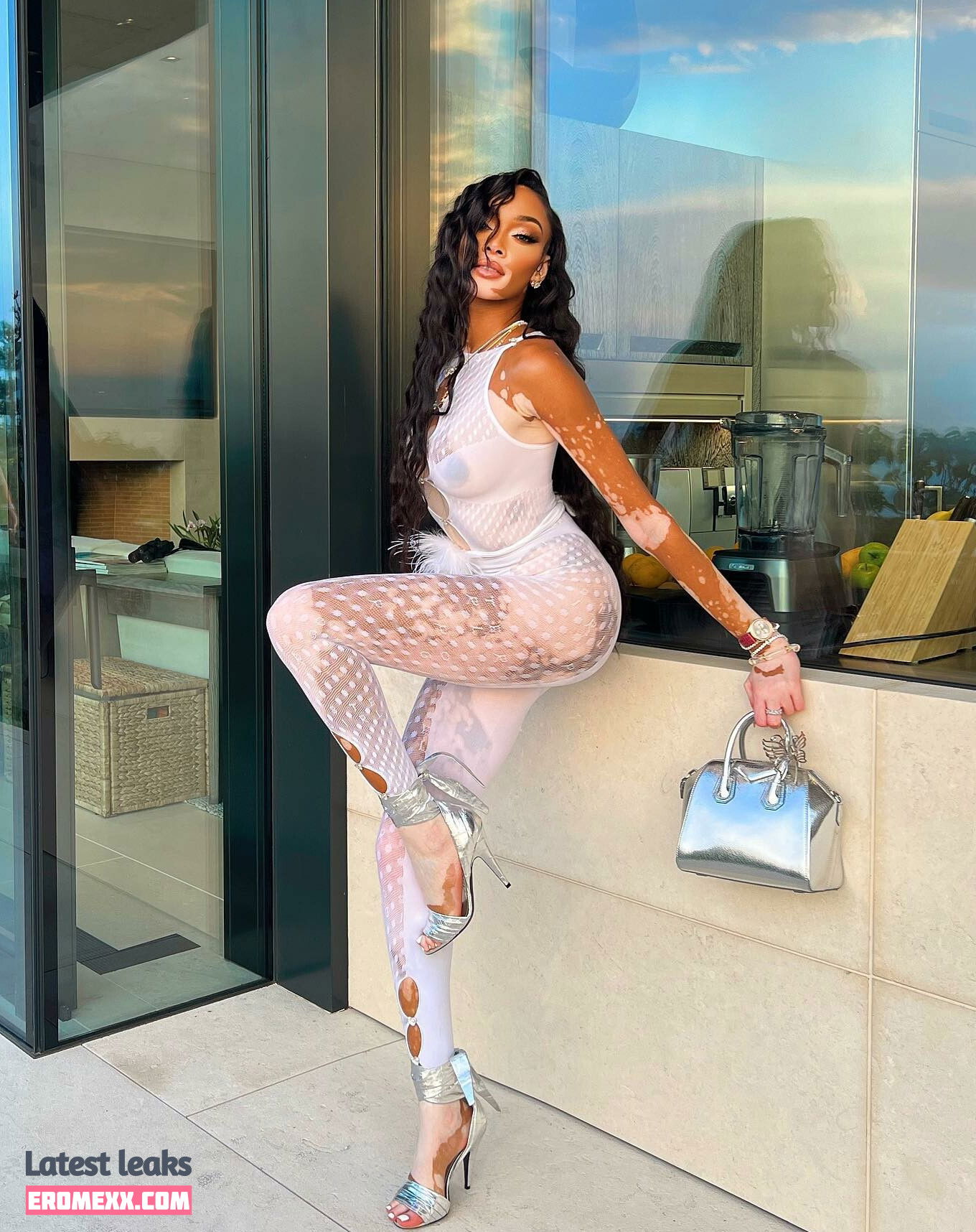 Latest Leaks Winnie Harlow Nude #1007 - Fapello