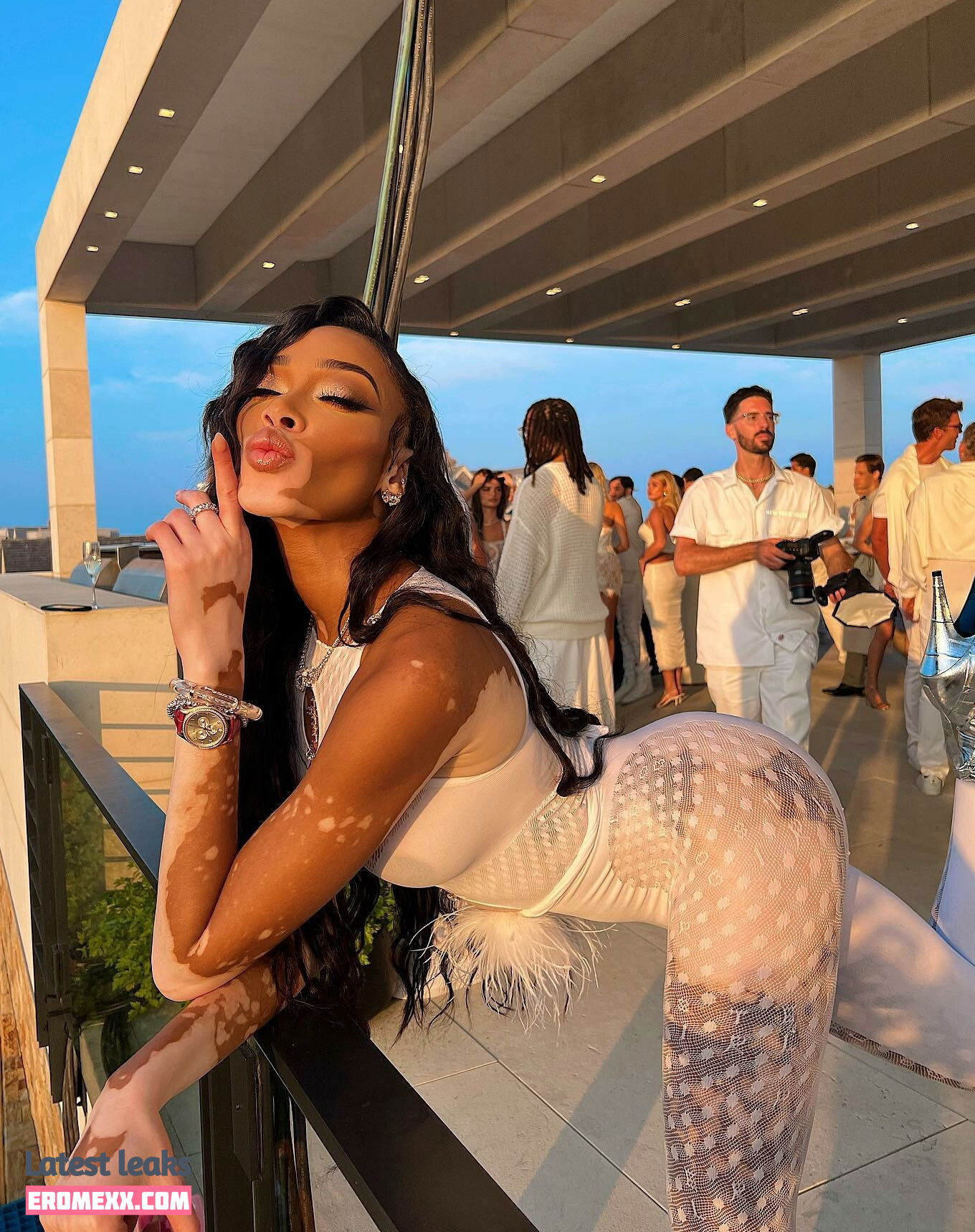 Latest Leaks Winnie Harlow Nude #1015 - Fapello