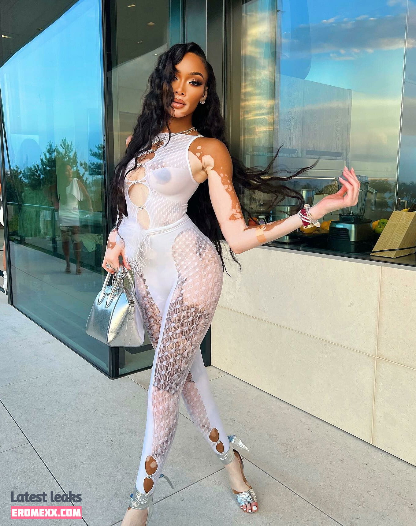 Latest Leaks Winnie Harlow Nude #1016 - Fapello