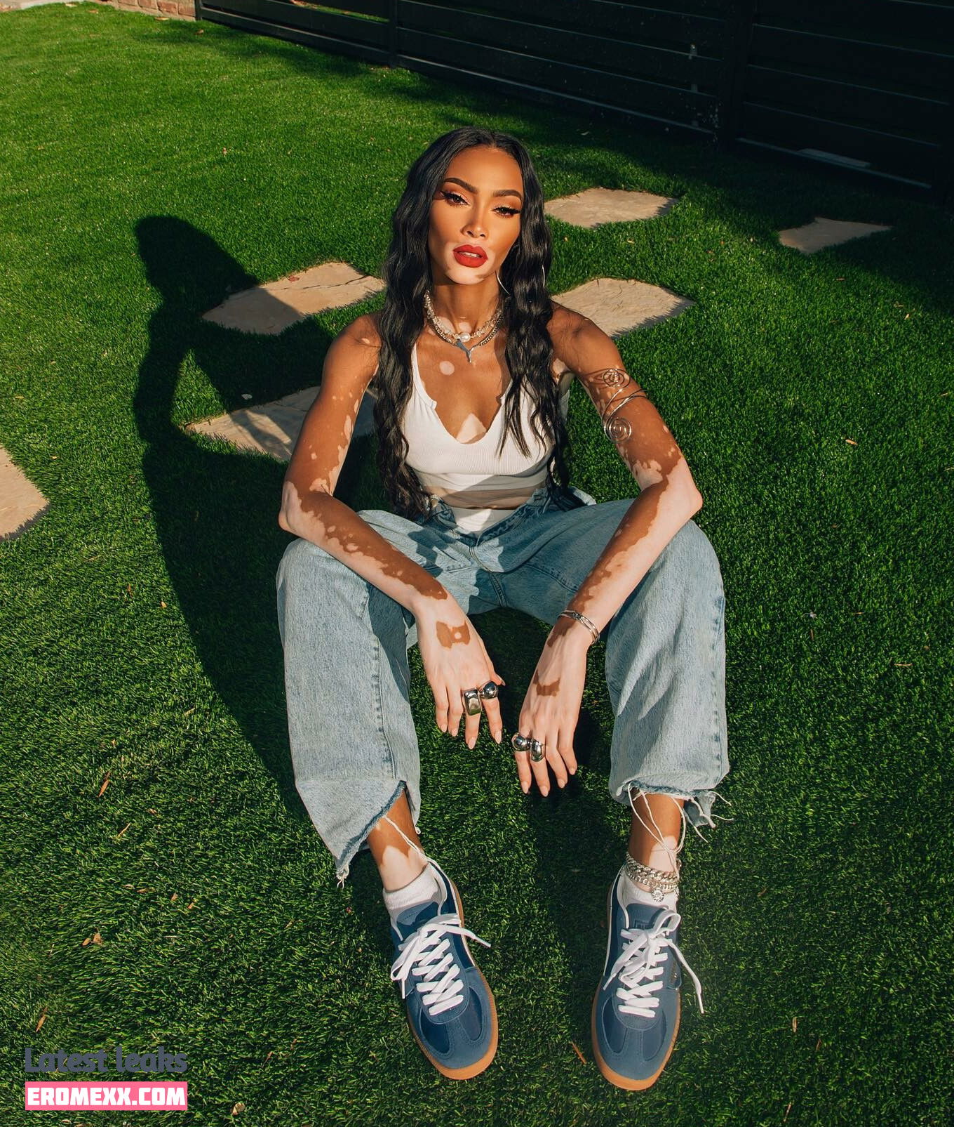 Latest Leaks Winnie Harlow Nude #1018 - Fapello