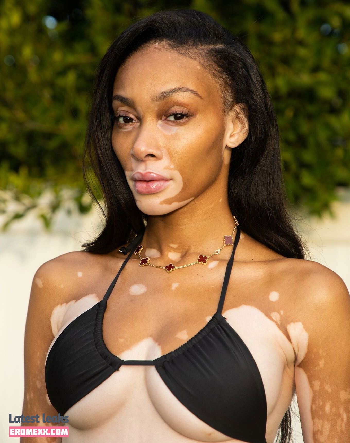 Latest Leaks Winnie Harlow Nude #1019 - Fapello