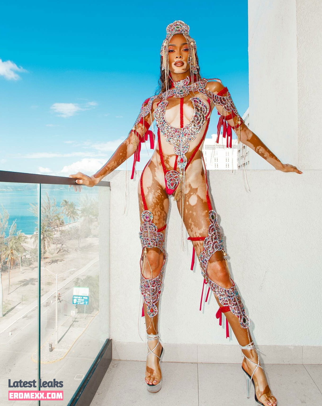 Latest Leaks Winnie Harlow Nude #1020 - Fapello