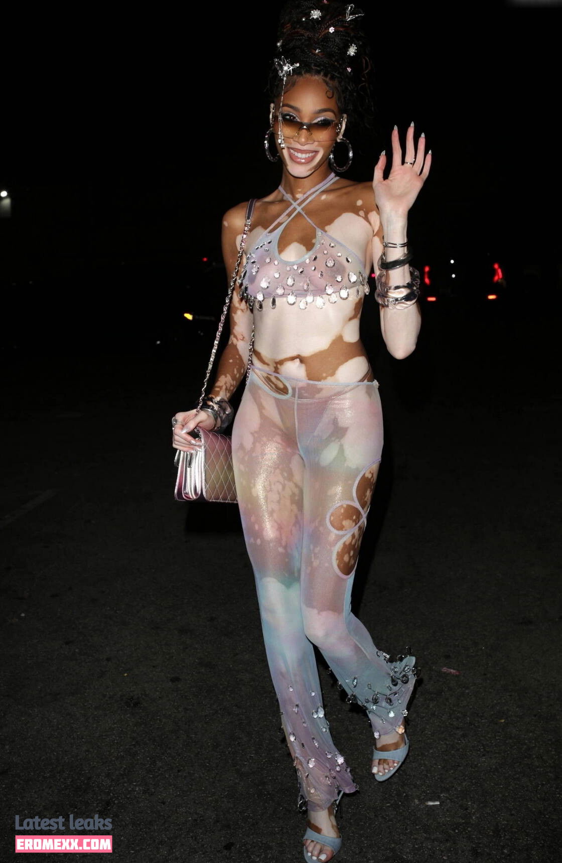 Latest Leaks Winnie Harlow Nude #1022 - Fapello