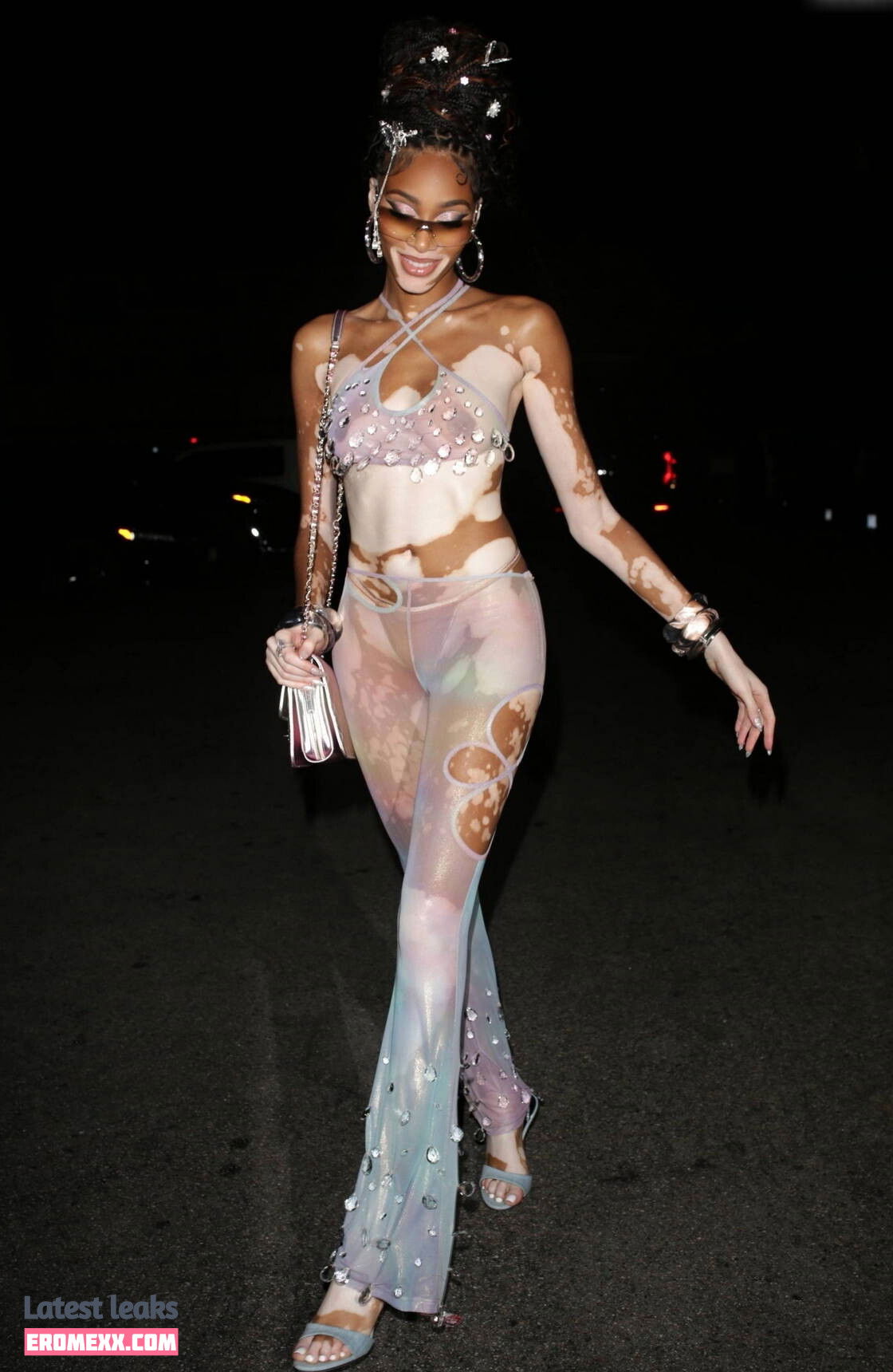 Latest Leaks Winnie Harlow Nude #1028 - Fapello