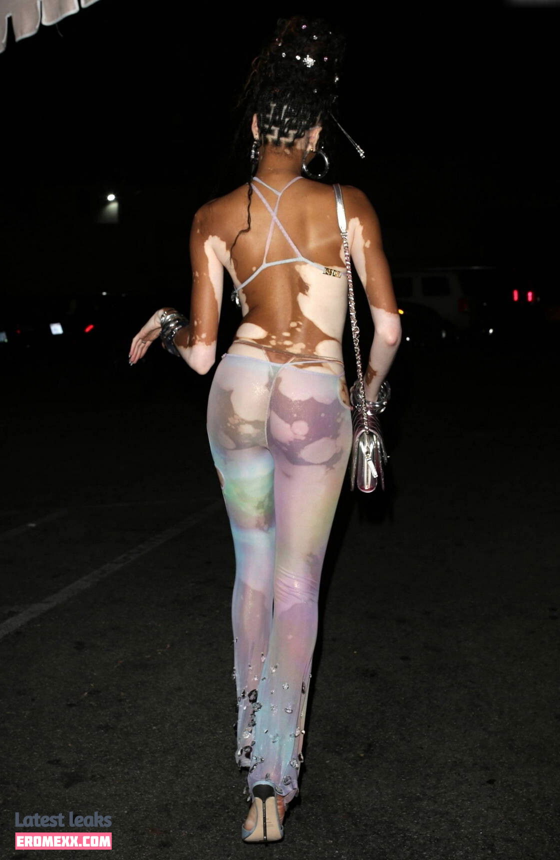Latest Leaks Winnie Harlow Nude #1029 - Fapello