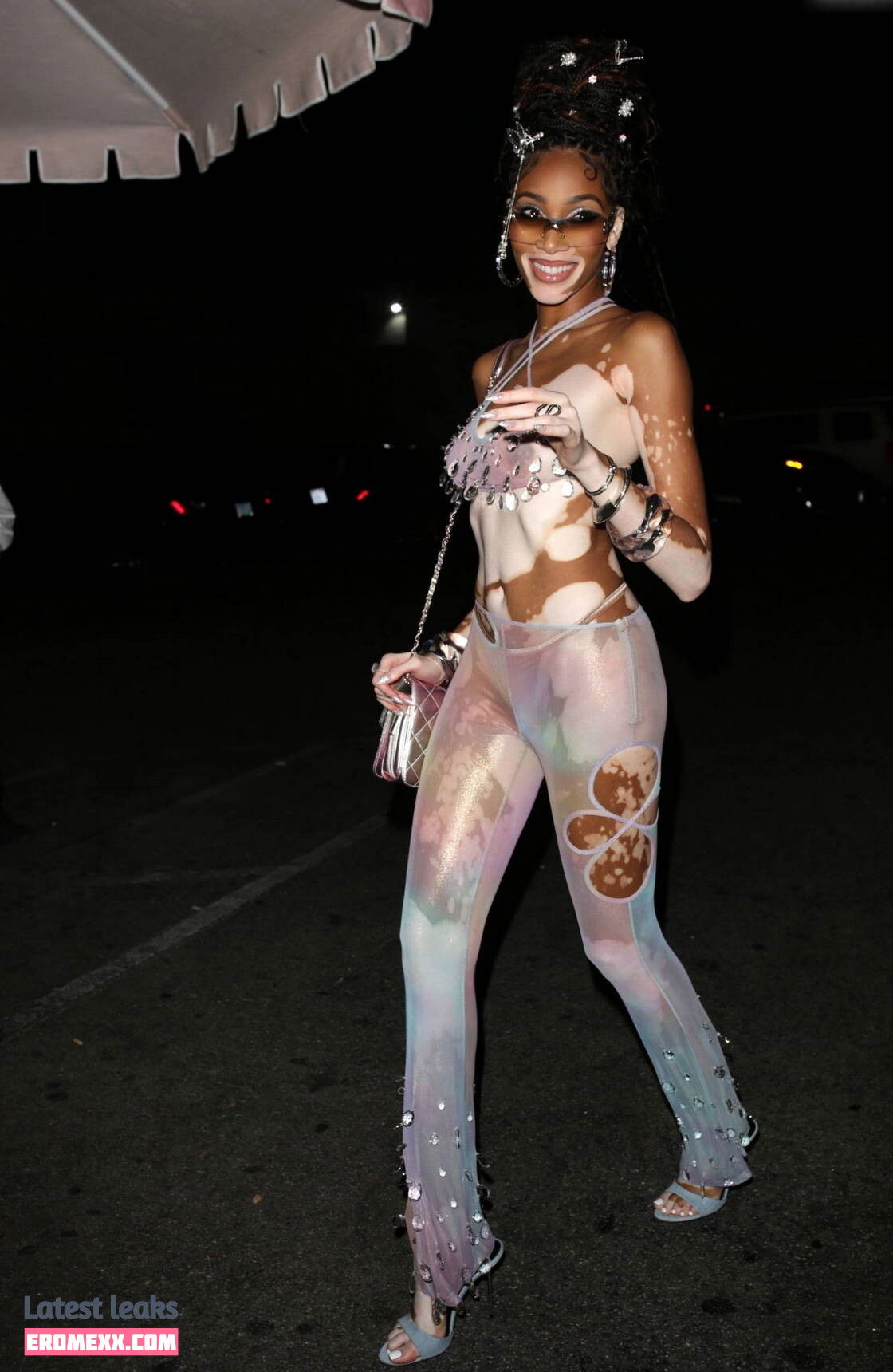 Latest Leaks Winnie Harlow Nude #1030 - Fapello