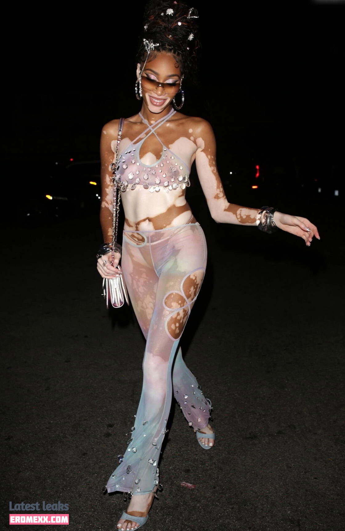 Latest Leaks Winnie Harlow Nude #1031 - Fapello