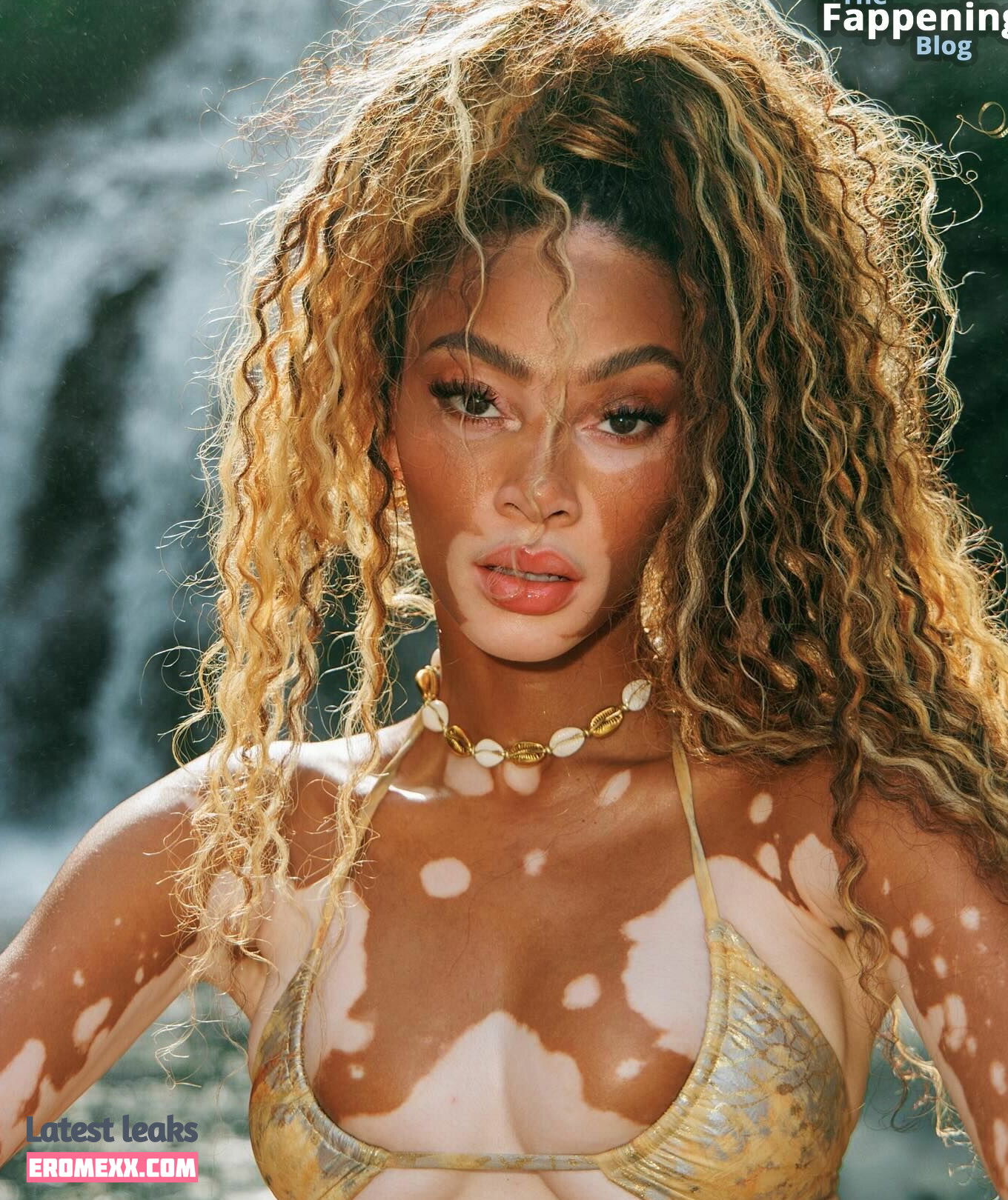 Latest Leaks Winnie Harlow Nude #1036 - Fapello