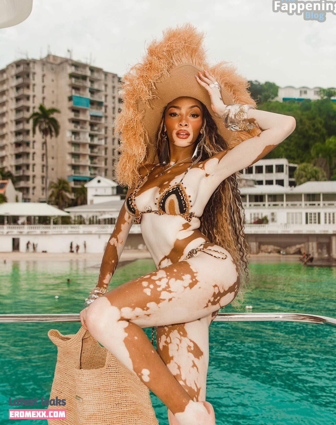 Latest Leaks Winnie Harlow Nude #1039 - Fapello