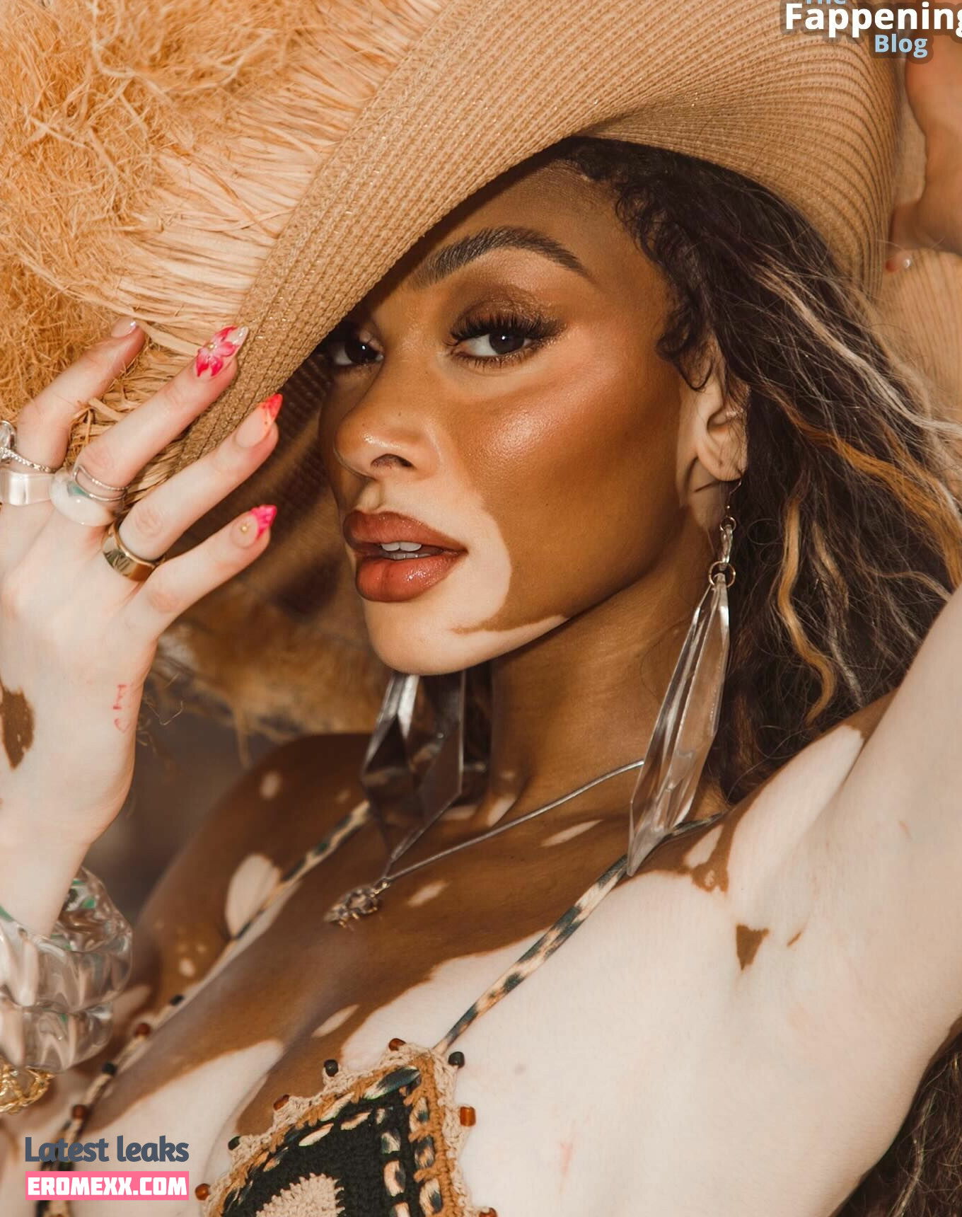 Latest Leaks Winnie Harlow Nude #1042 - Fapello