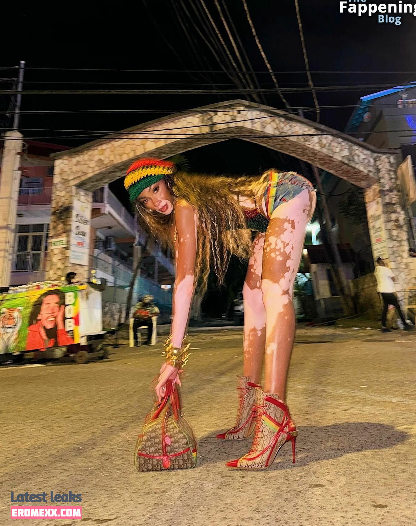 Latest Leaks Winnie Harlow Nude #1045 - Fapello