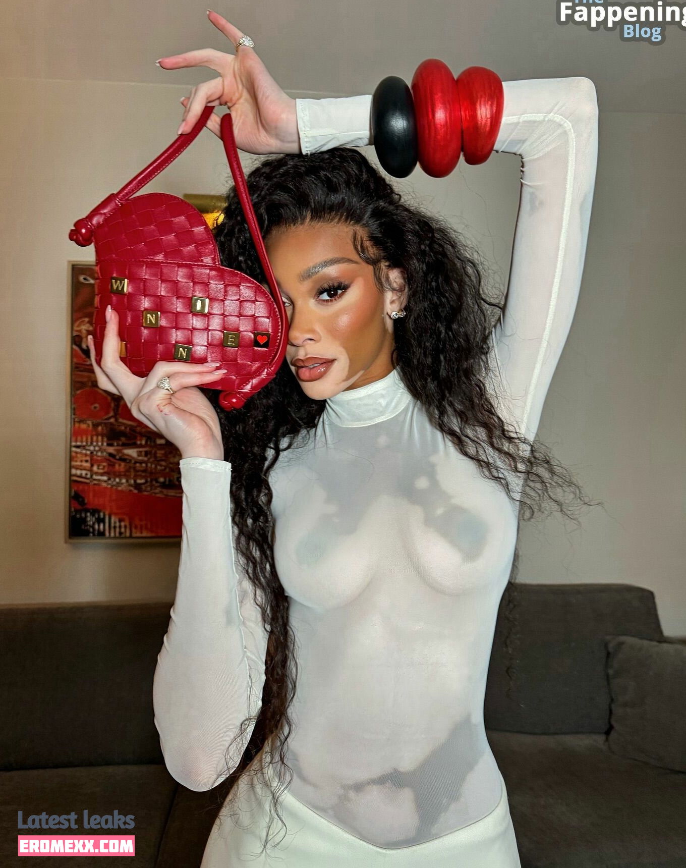 Latest Leaks Winnie Harlow Nude #1098 - Fapello