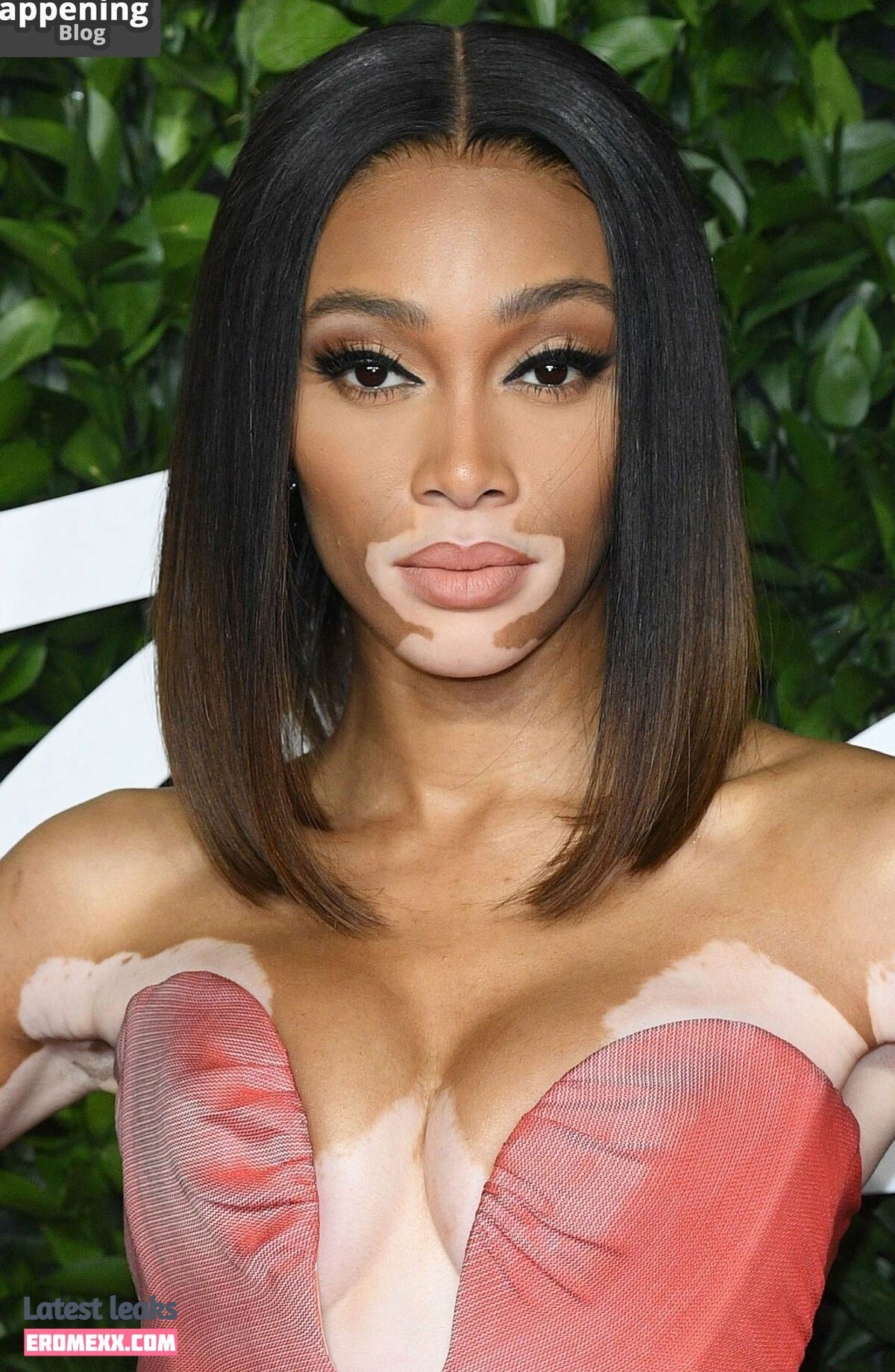 Latest Leaks Winnie Harlow Nude #1109 - Fapello