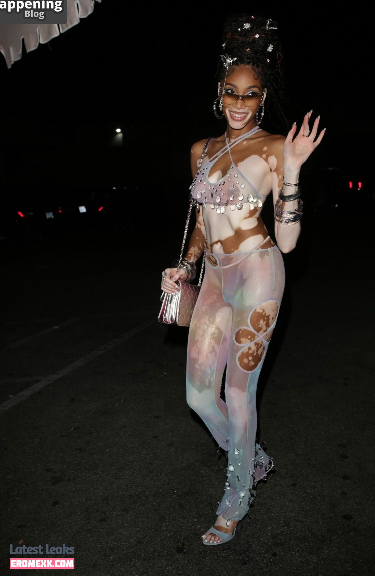 Latest Leaks Winnie Harlow Nude #1113 - Fapello