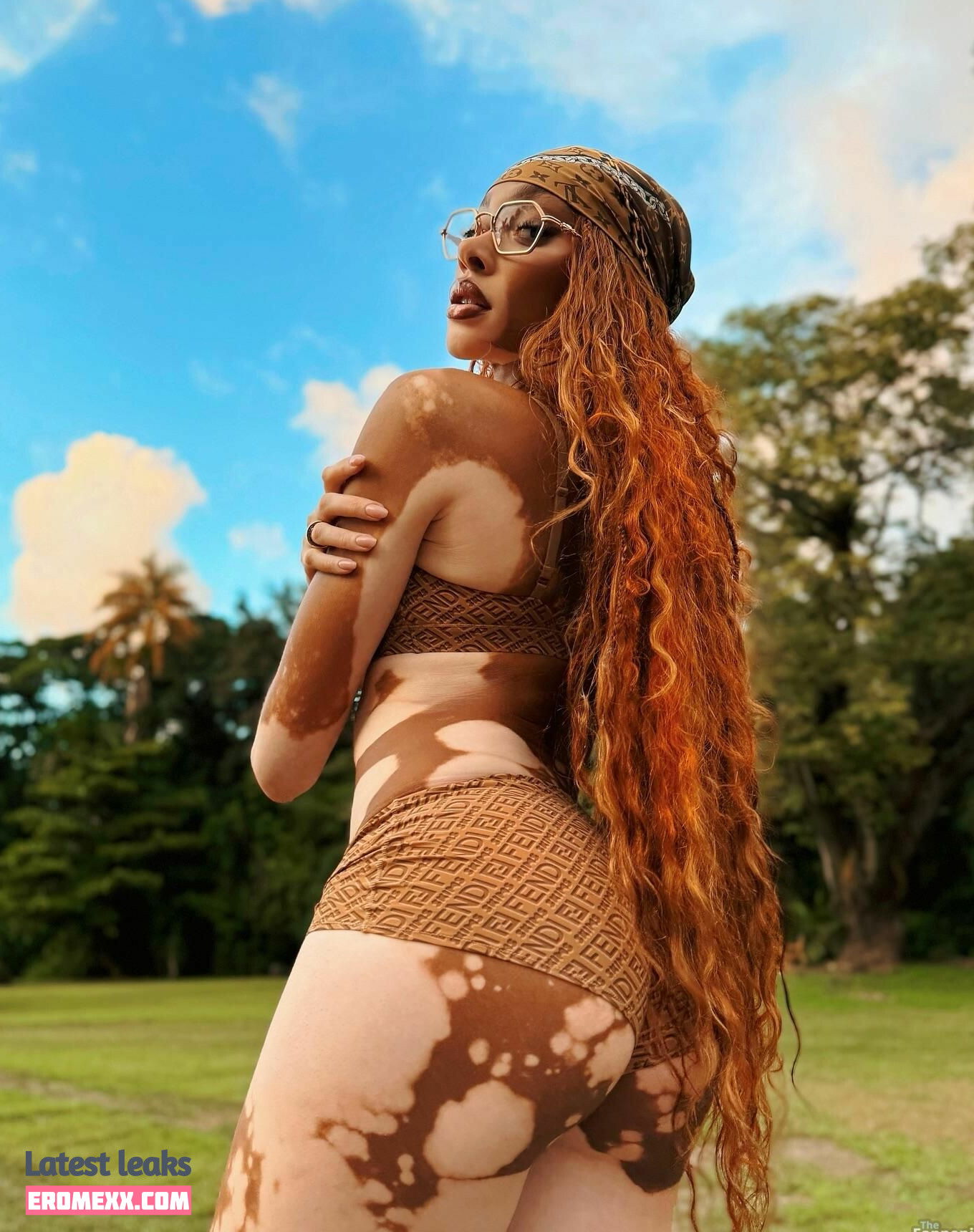 Latest Leaks Winnie Harlow Nude #1119 - Fapello