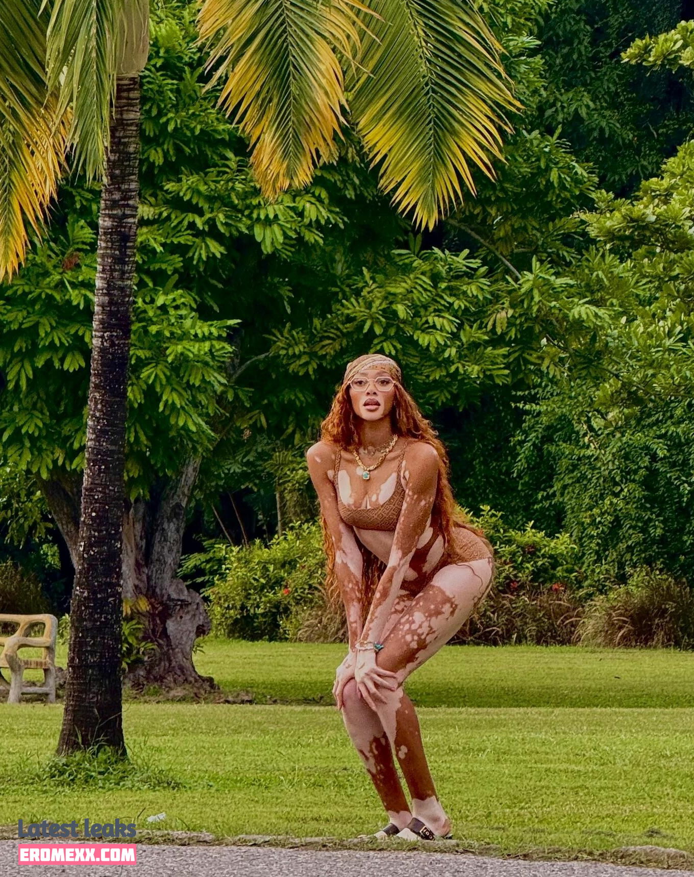 Latest Leaks Winnie Harlow Nude #1121 - Fapello