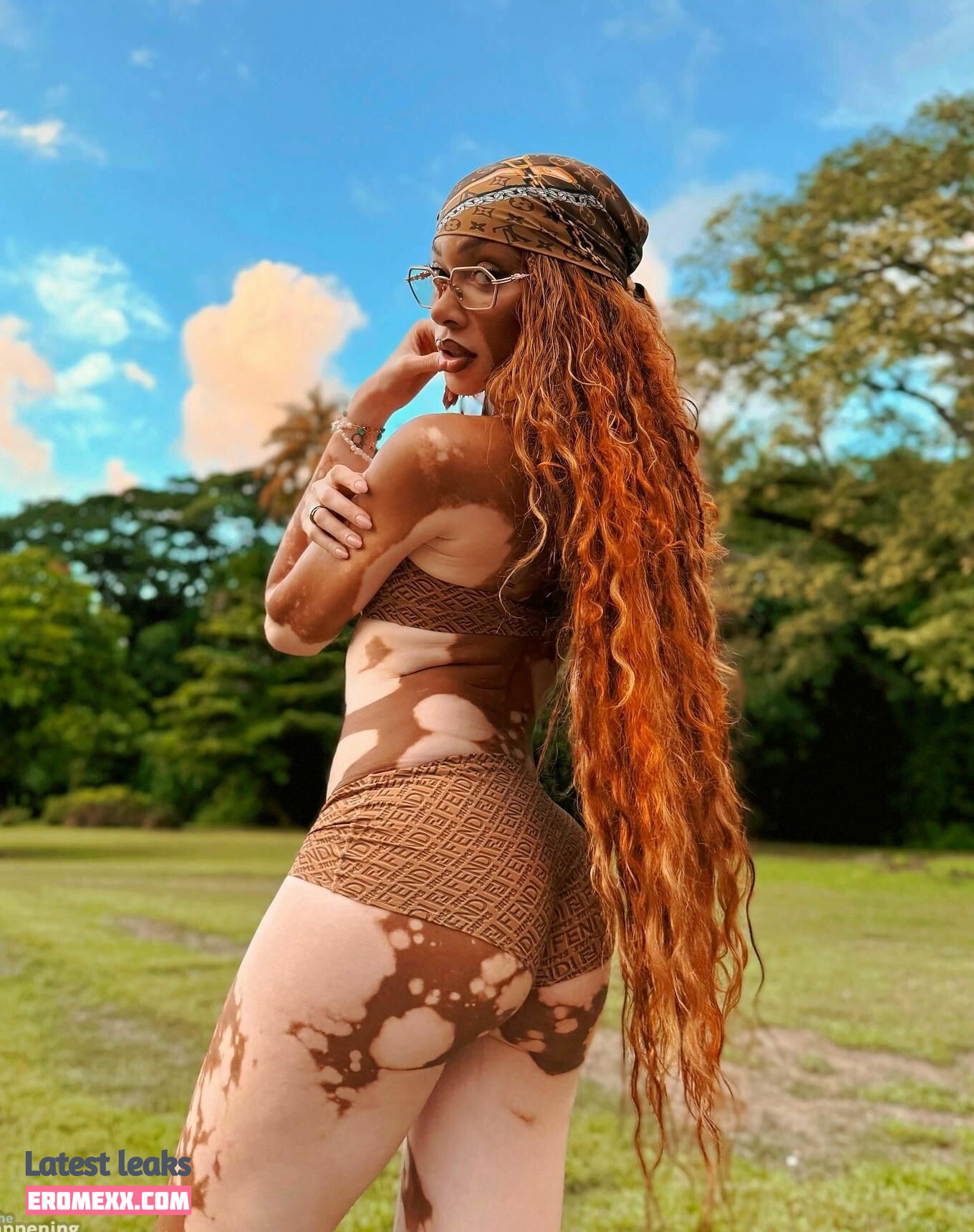 Latest Leaks Winnie Harlow Nude #1122 - Fapello