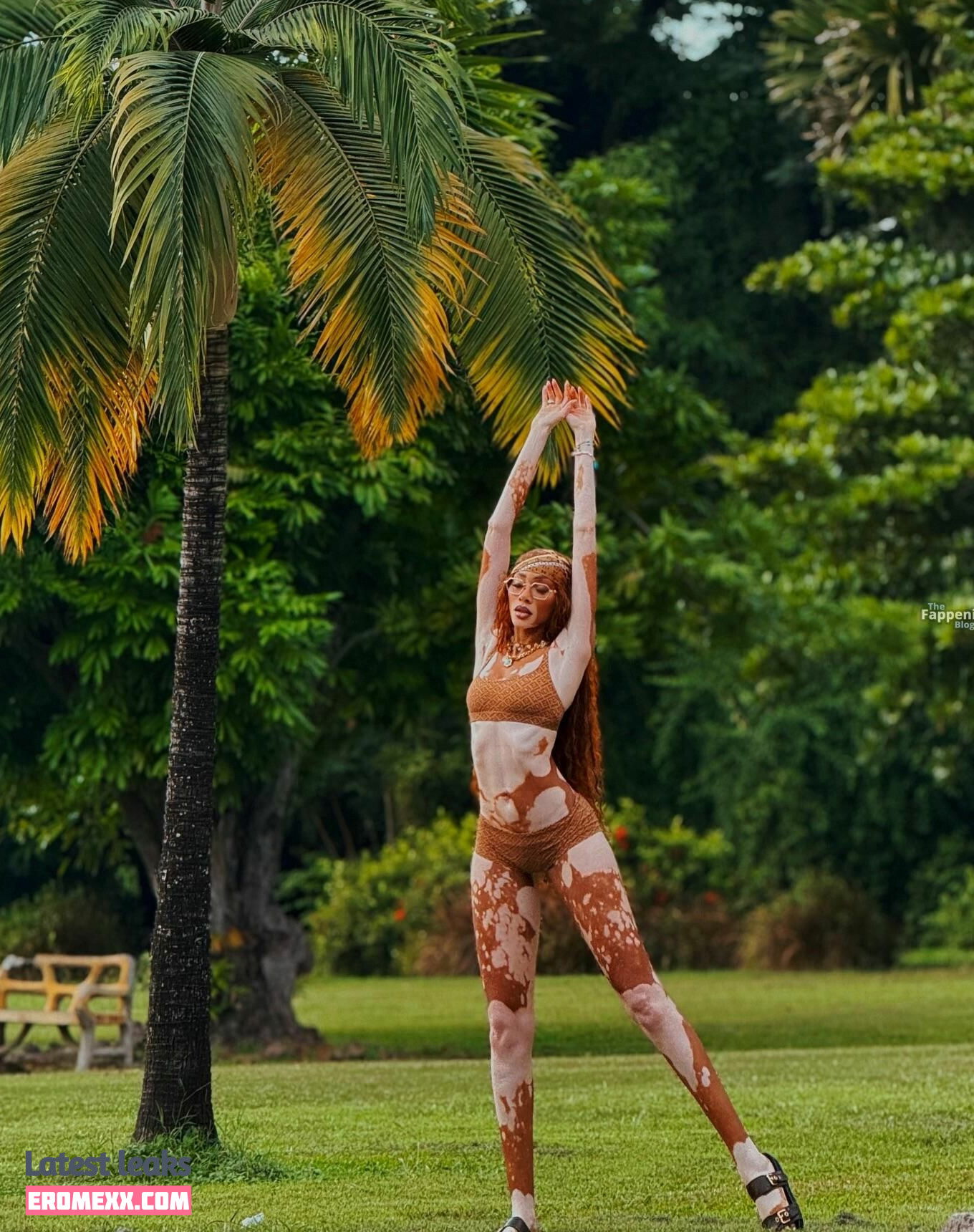 Latest Leaks Winnie Harlow Nude #1123 - Fapello
