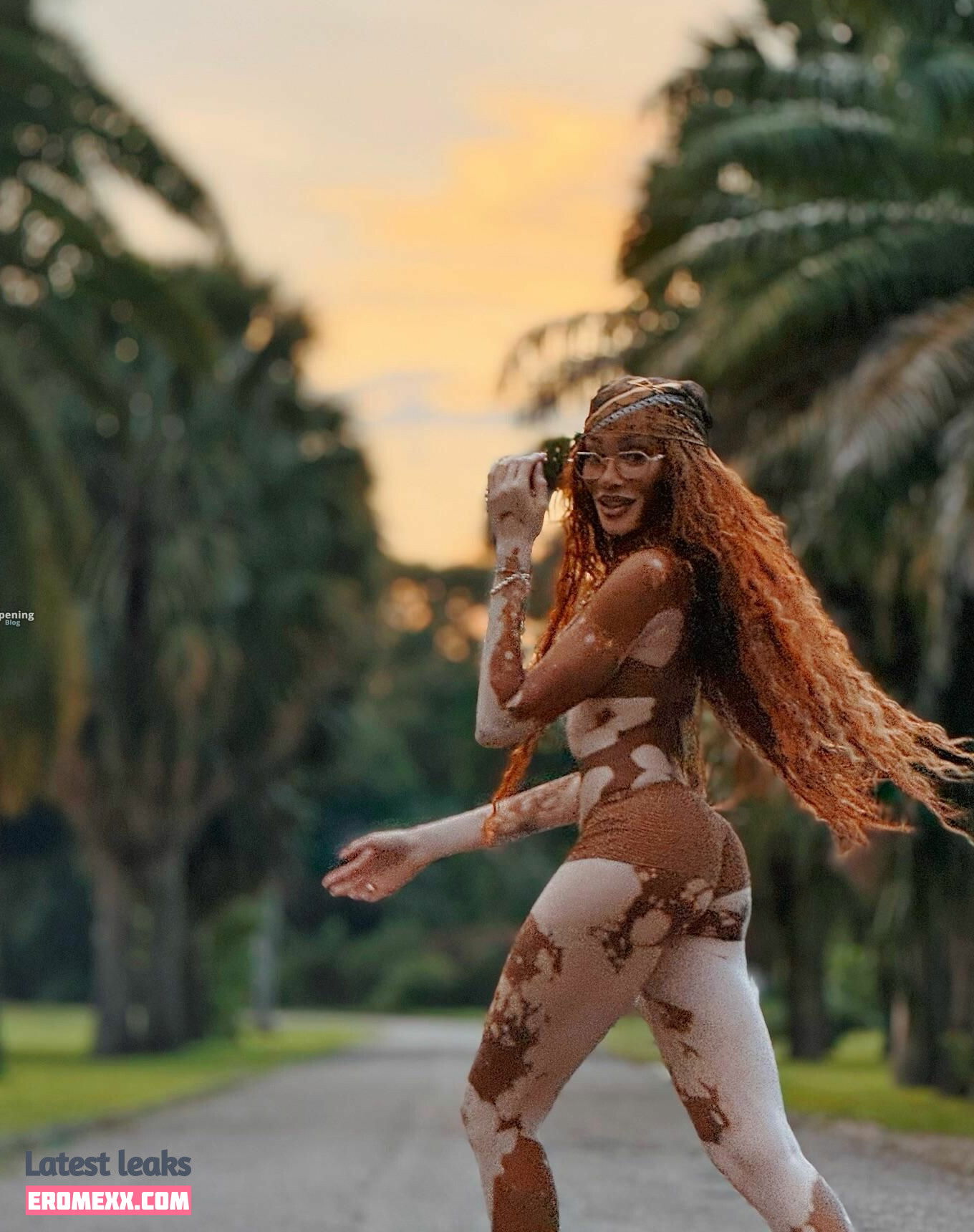 Latest Leaks Winnie Harlow Nude #1125 - Fapello