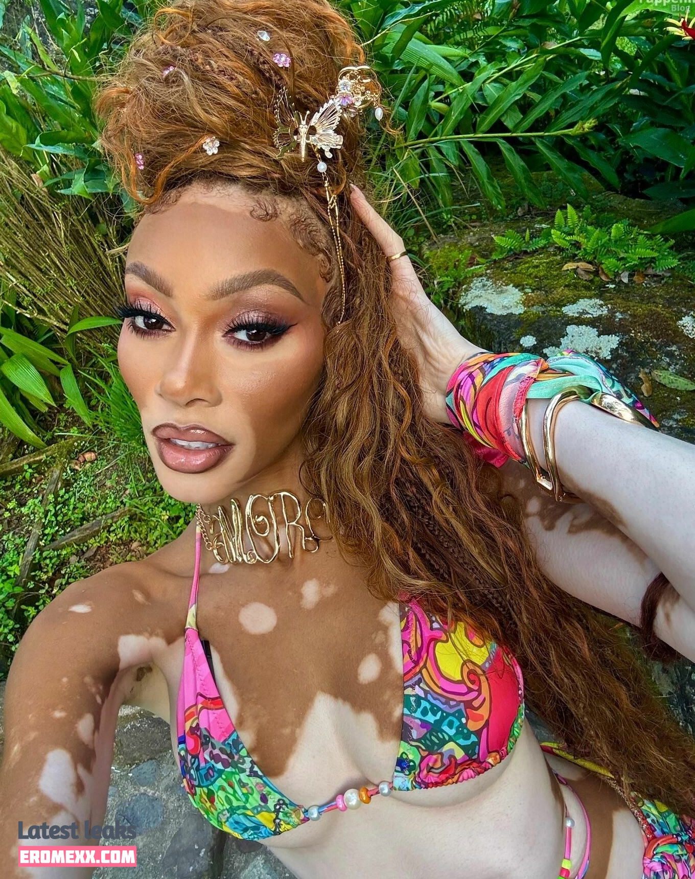 Latest Leaks Winnie Harlow Nude #1132 - Fapello