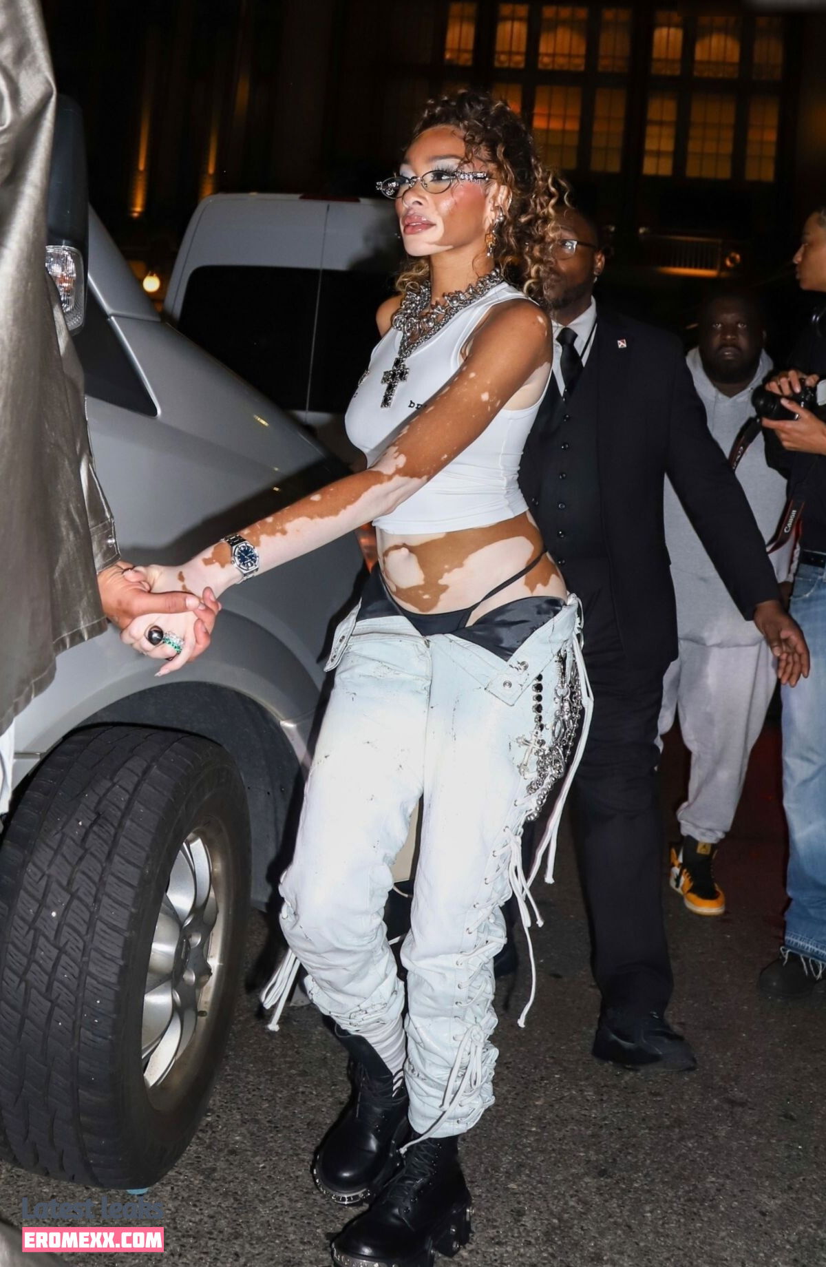Latest Leaks Winnie Harlow Nude #1141 - Fapello