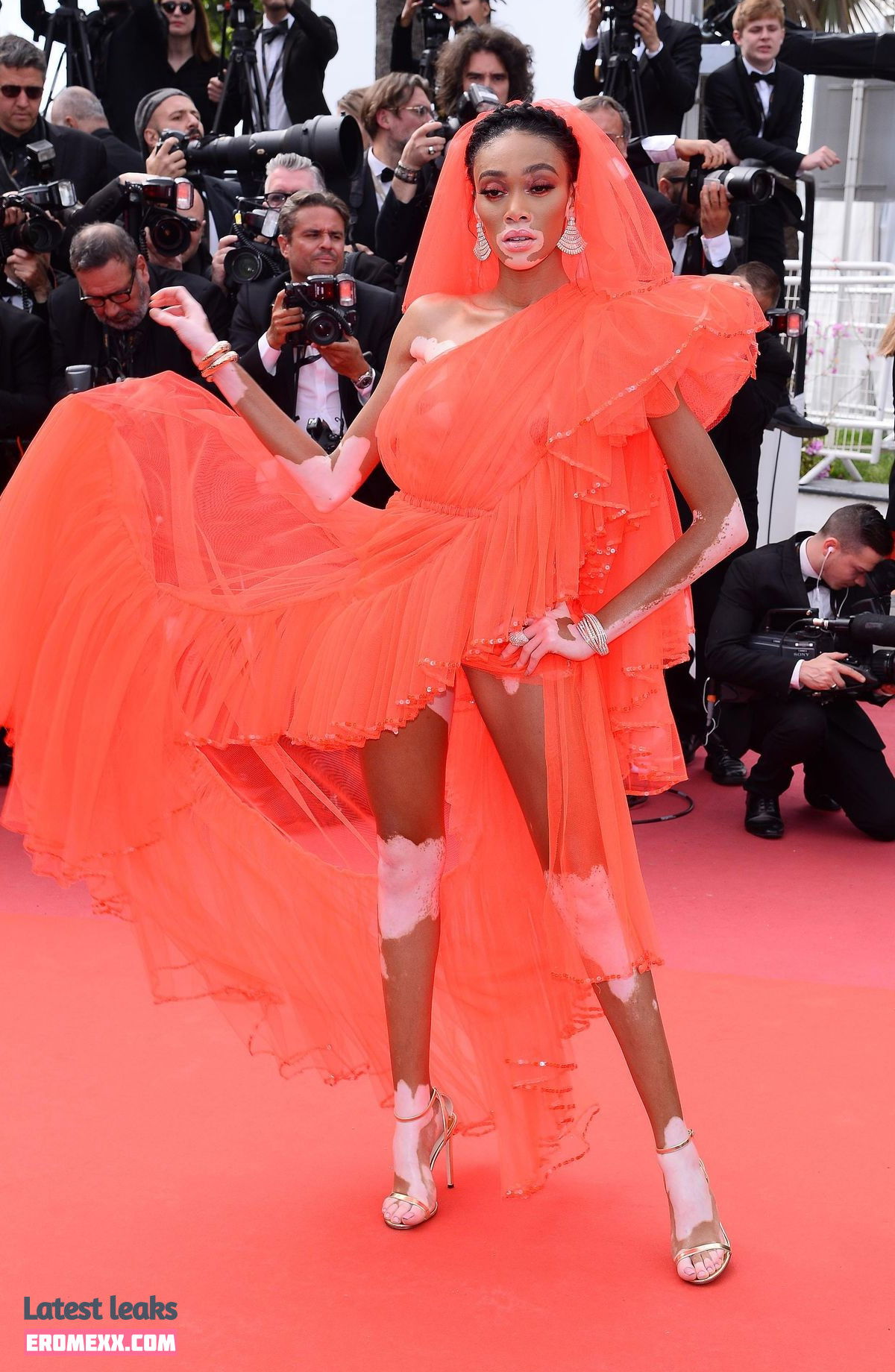 Latest Leaks Winnie Harlow Nude #169 - Fapello