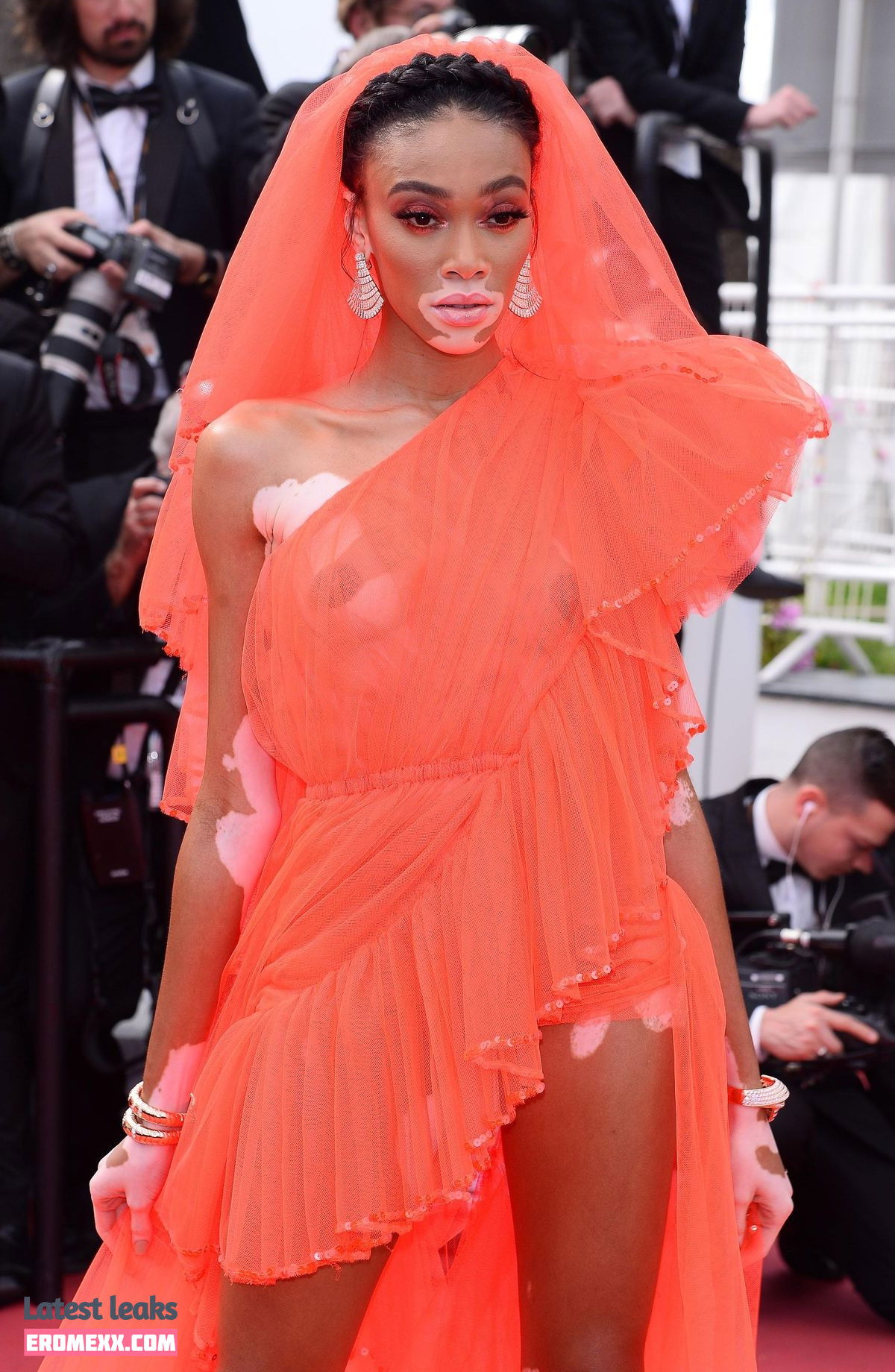 Latest Leaks Winnie Harlow Nude #178 - Fapello
