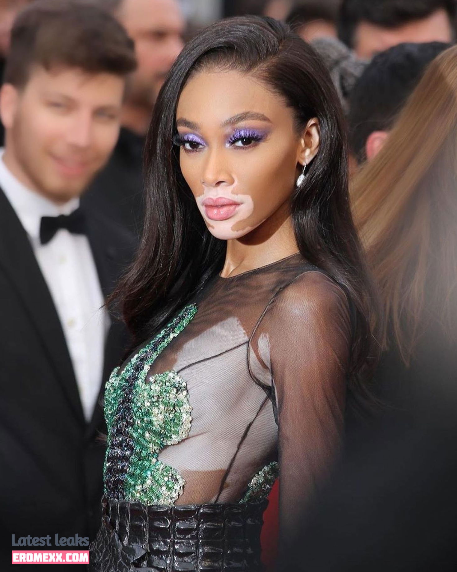 Latest Leaks Winnie Harlow Nude #207 - Fapello