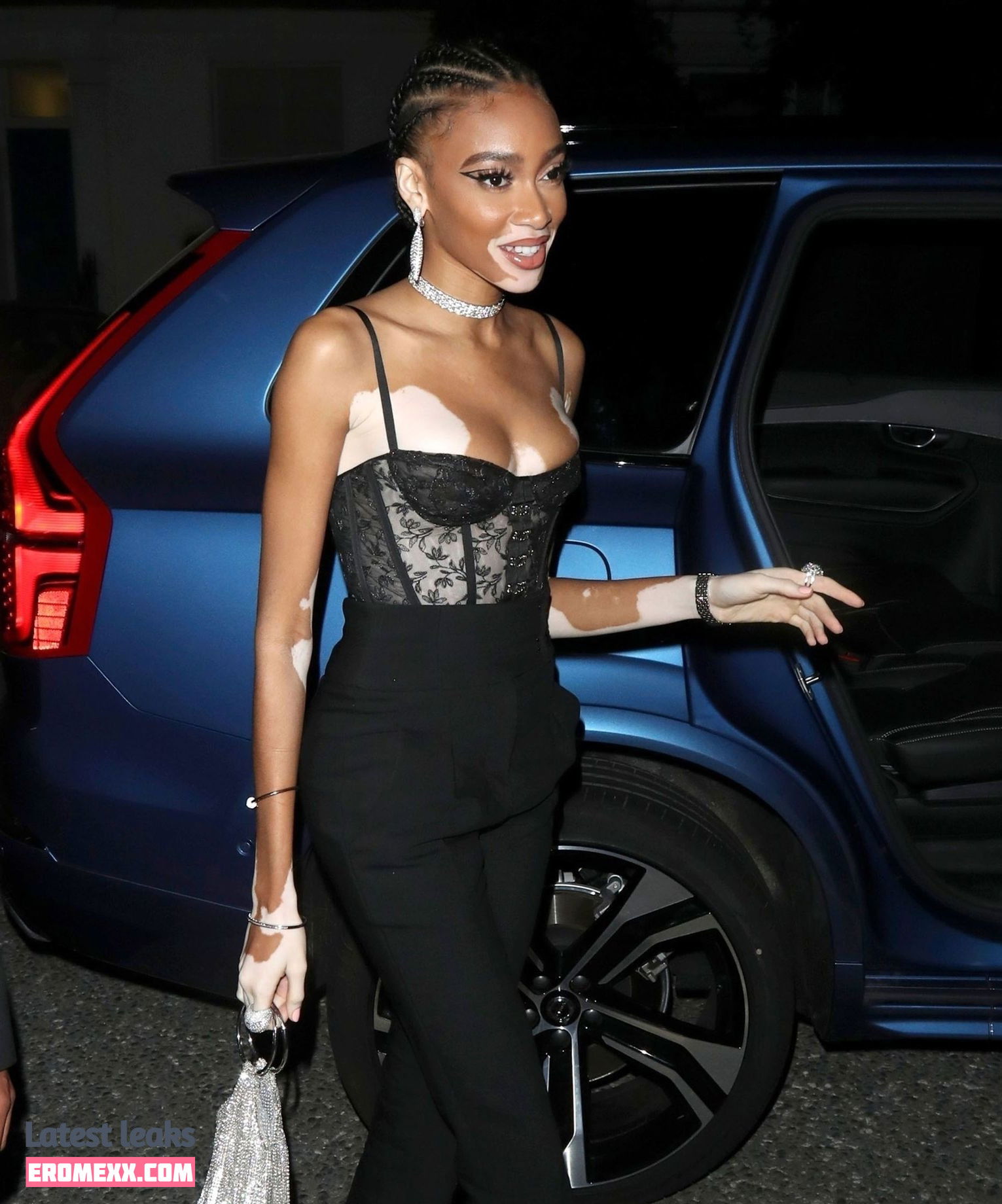 Latest Leaks Winnie Harlow Nude #223 - Fapello