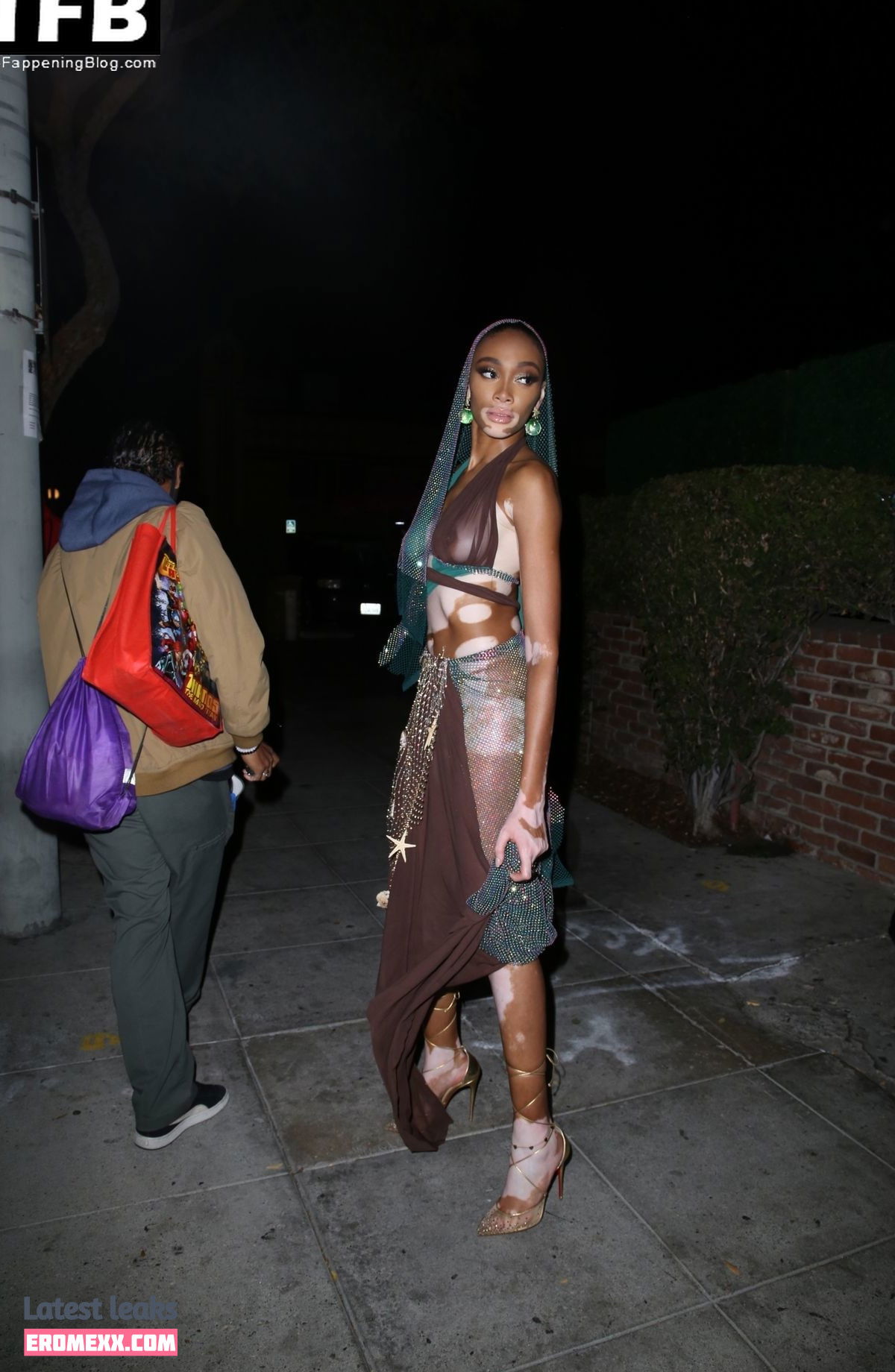 Latest Leaks Winnie Harlow Nude #354 - Fapello