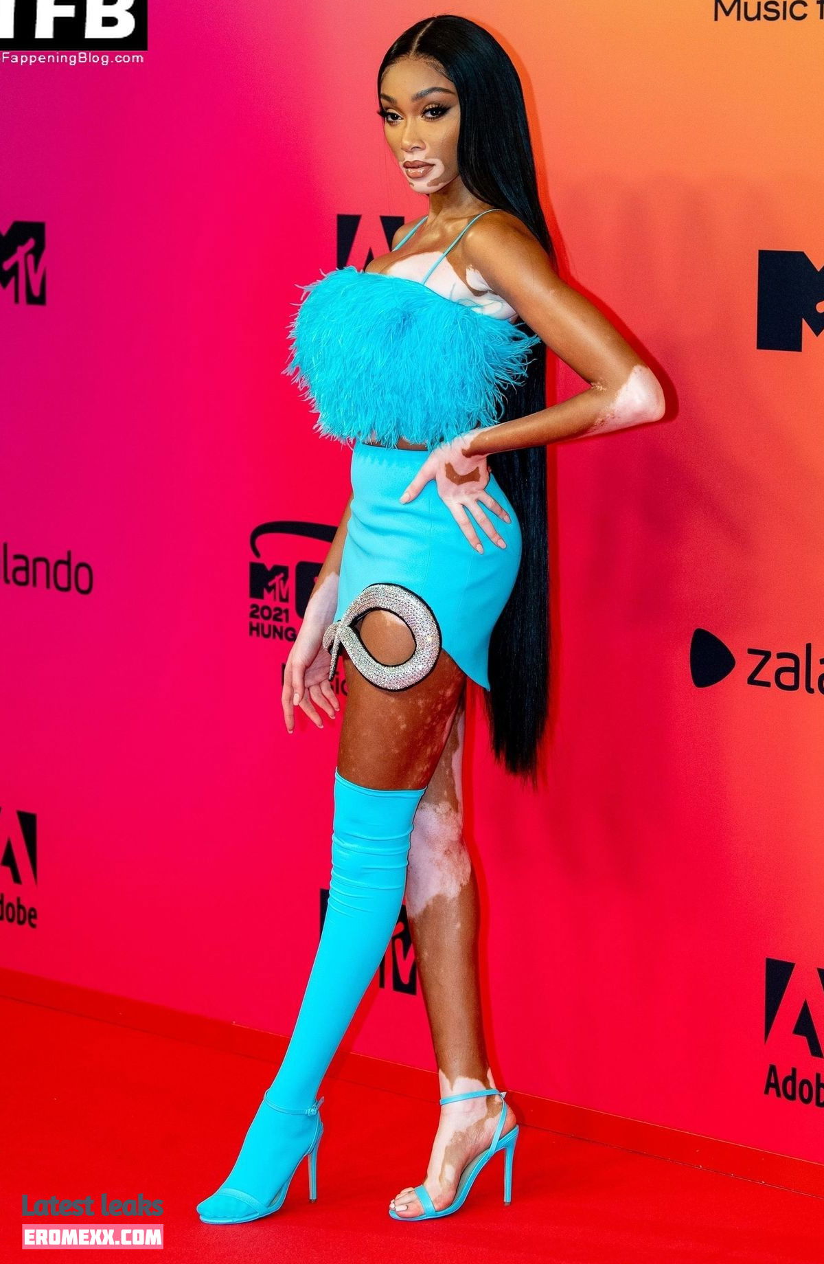 Latest Leaks Winnie Harlow Nude #412 - Fapello