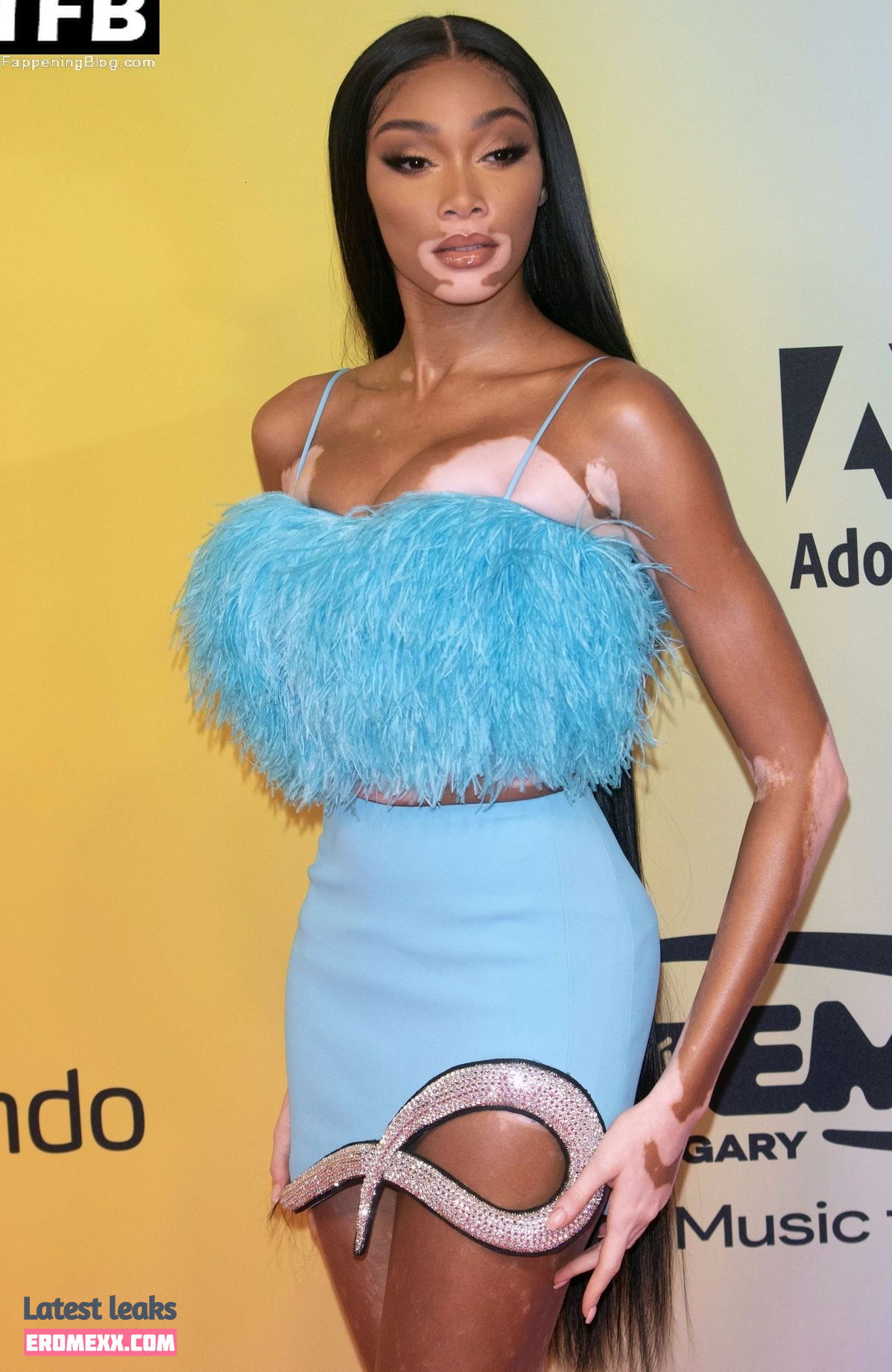 Latest Leaks Winnie Harlow Nude #414 - Fapello