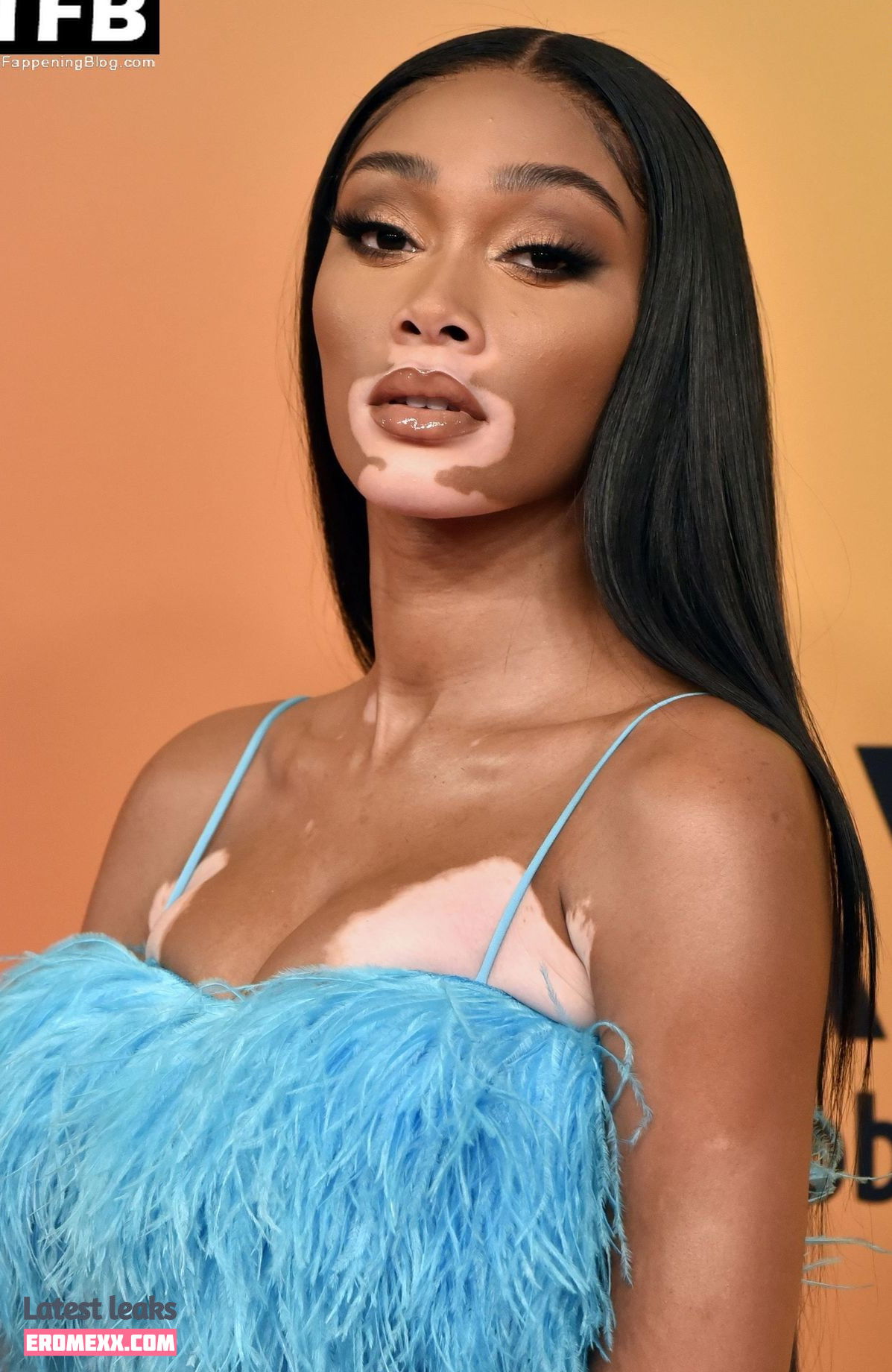 Latest Leaks Winnie Harlow Nude #416 - Fapello