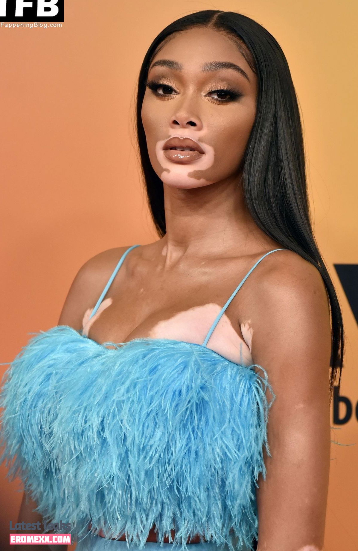 Latest Leaks Winnie Harlow Nude #418 - Fapello
