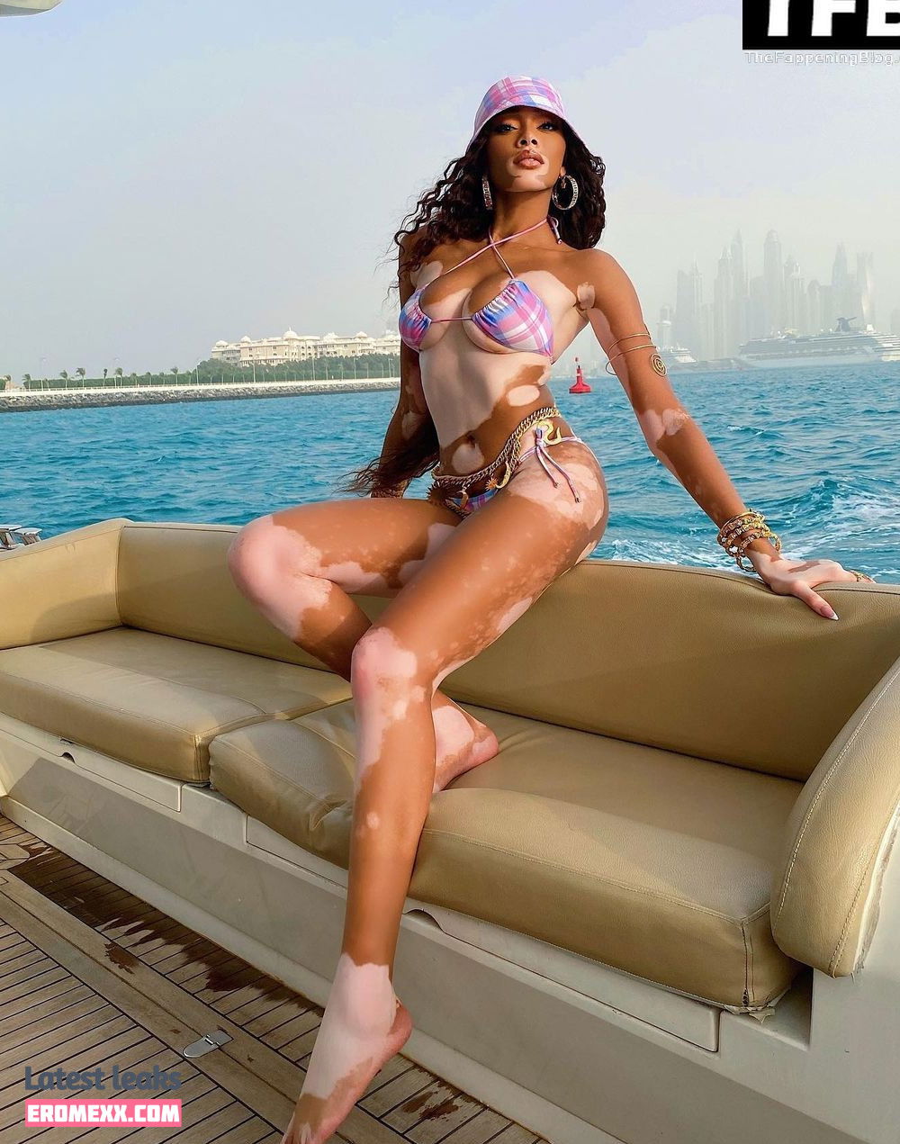 Latest Leaks Winnie Harlow Nude #434 - Fapello