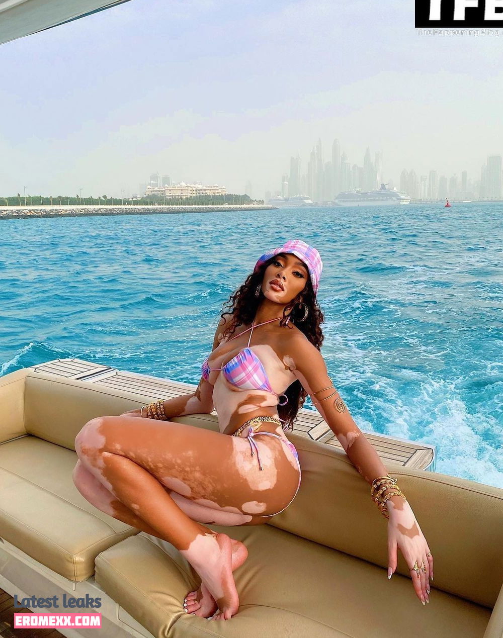 Latest Leaks Winnie Harlow Nude #439 - Fapello