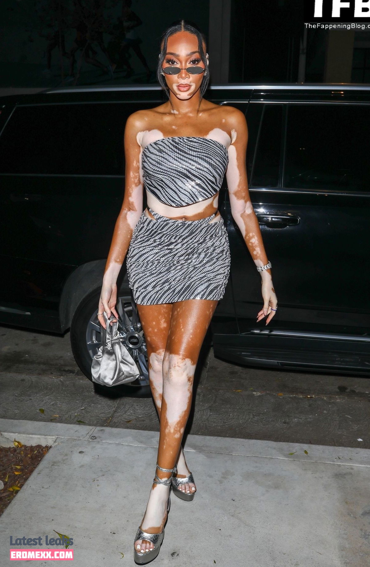 Latest Leaks Winnie Harlow Nude #452 - Fapello