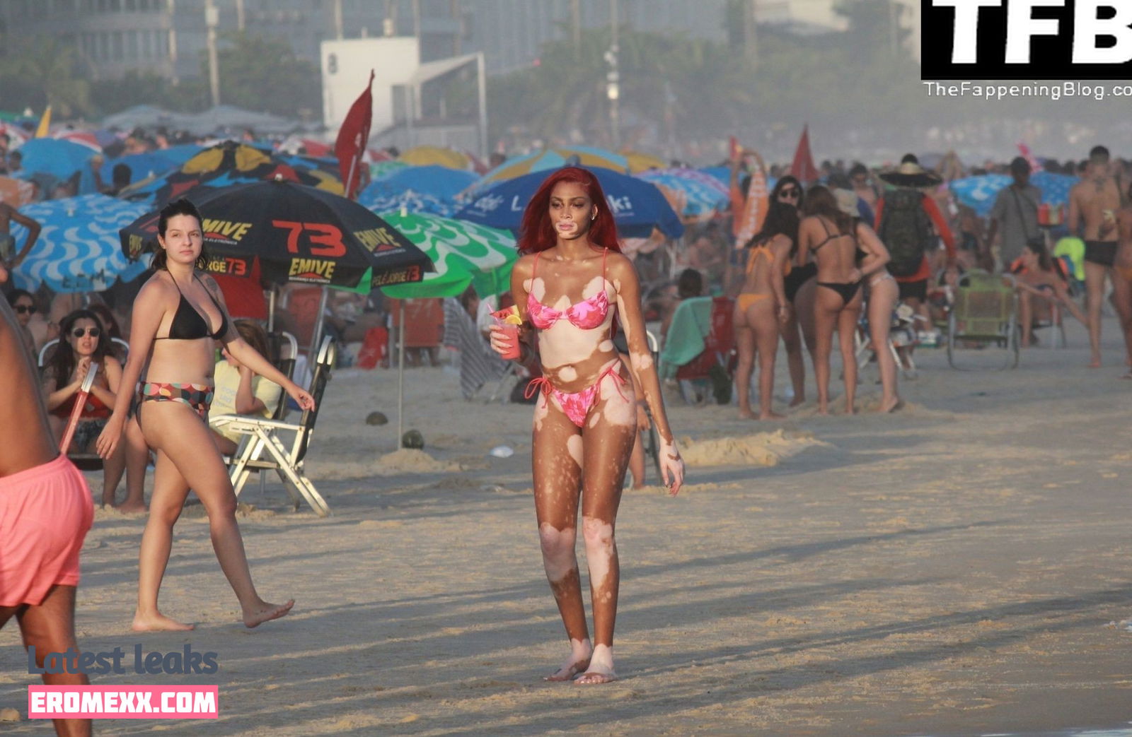 Latest Leaks Winnie Harlow Nude #497 - Fapello