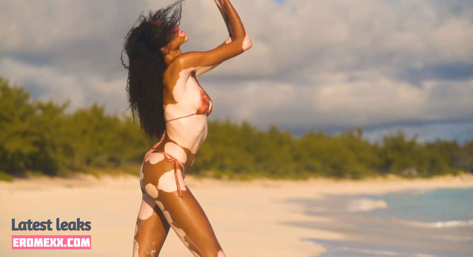 Latest Leaks Winnie Harlow Nude #54 - Fapello