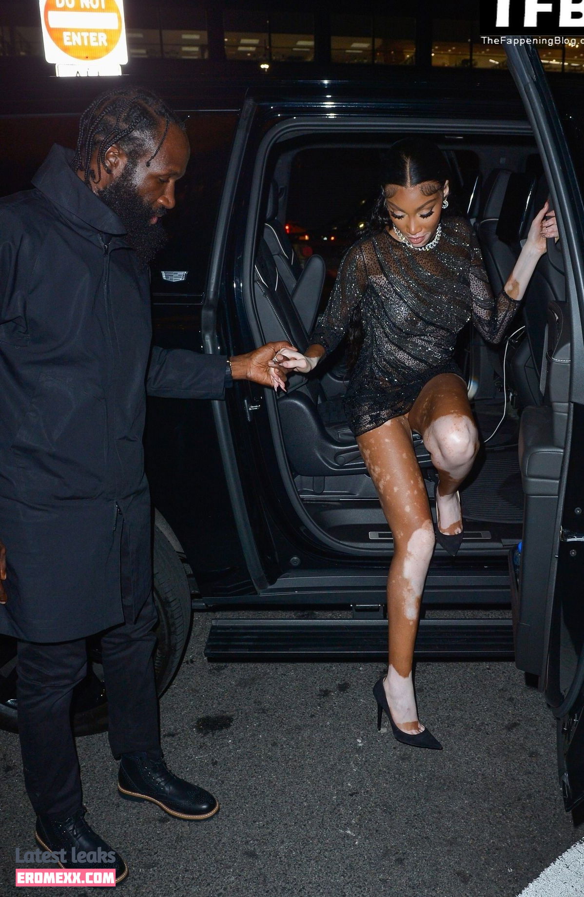 Latest Leaks Winnie Harlow Nude #650 - Fapello