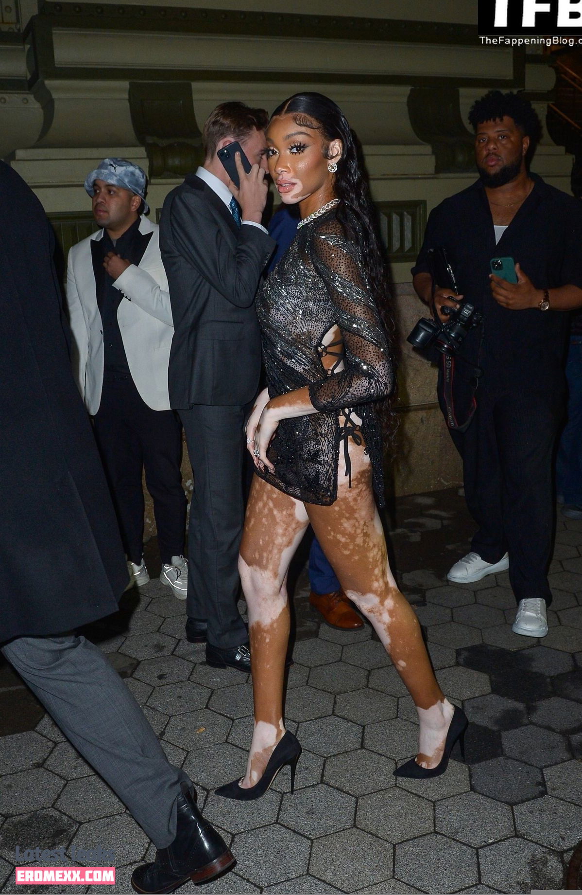 Latest Leaks Winnie Harlow Nude #659 - Fapello