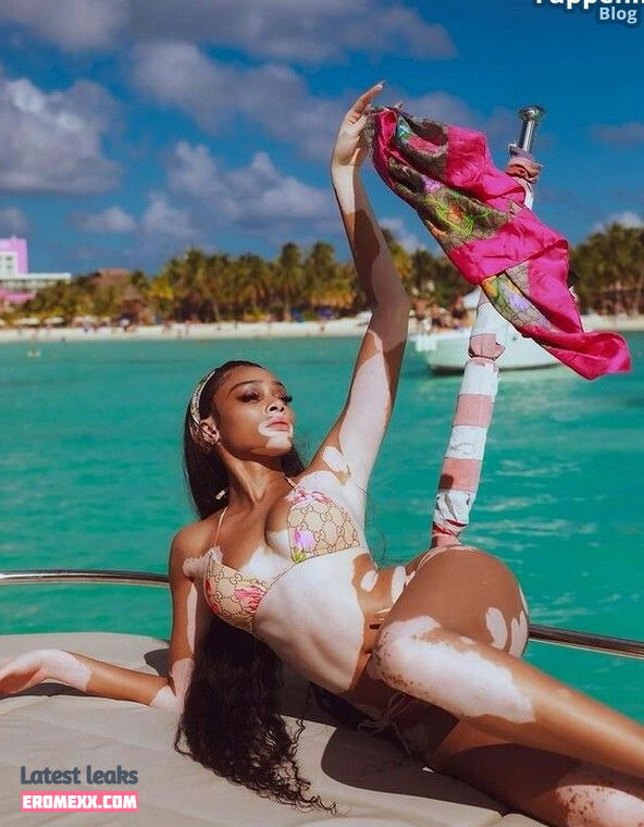 Latest Leaks Winnie Harlow Nude #844 - Fapello