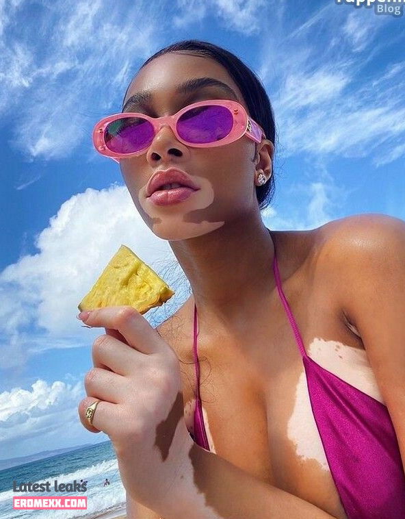 Latest Leaks Winnie Harlow Nude #845 - Fapello
