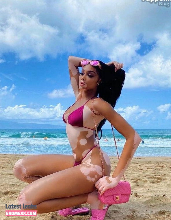 Latest Leaks Winnie Harlow Nude #846 - Fapello