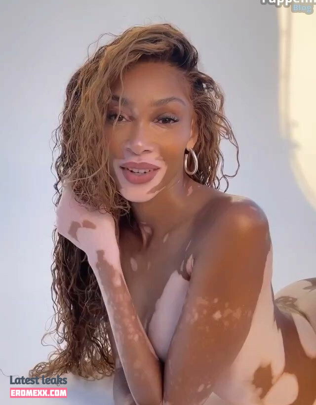Latest Leaks Winnie Harlow Nude #854 - Fapello