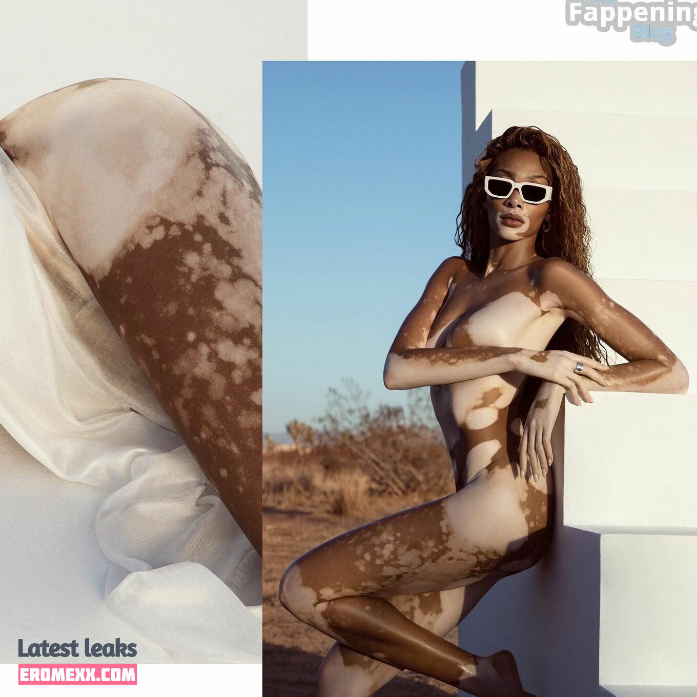 Latest Leaks Winnie Harlow Nude #863 - Fapello